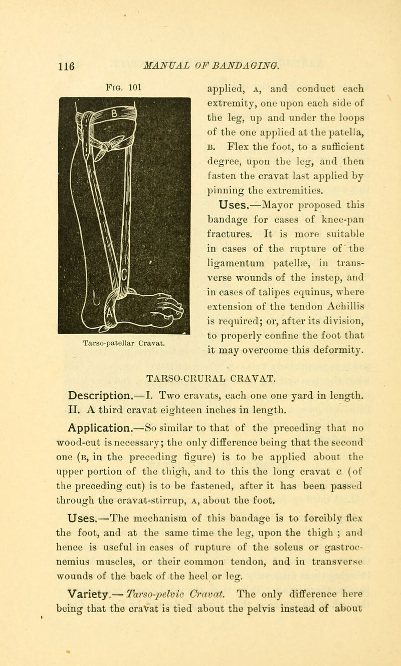 Fig. 101 Tarso-patellar Cravat. applied, a, and conduct each extremity, one upon each side of the leg, up and under the loops of the one applied at the patella, B. Flex the foot, to a sufficient degree, upon the leg, and then fasten the cravat last applied by- pinning the extremities. Uses.—Mayor proposed this bandage for cases of knee-pan fractures. It is more suitable in cases of the rupture of the ligamentum patella?, in trans- verse wounds of the instep, and in cases of talipes equinus, where extension of the tendon Achillis is required; or, after its division, to properly confine the foot that it may overcome this deformity. TARSO-CRURAL CRAVAT. Description.—I. Two cravats, each one one yard in length. II. A third cravat eighteen inches in length. Application.—So similar to that of the preceding that no wood-cut is necessary; the only difference being that the second one (b, in the preceding figure) is to be applied about the upper portion of the thigh, and to this the long cravat c (of the preceding cut) is to be fastened, after it has been passed through the cravat-stirrup, a, about the foot. Uses.—The mechanism of this bandage is to forcibly flox the foot, and at the same time the leg, upon the thigh ; and hence is useful in cases of rupture of the soleus or gastroc- nemius muscles, or their common tendon, and in transverse wounds of the back of the heel or leg. Variety,— Tarso-pelvic Cravat. The only difference here being that the ci'aVat is tied about the pelvis instead of about