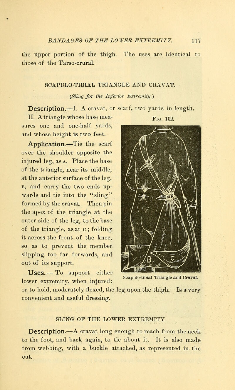 the upper portion of the thigh. The uses are identical to those of the Tarso-crural. SCAPULO-TIBIAL TRIANGLE AND CRAVAT. (Sling for iJie Inferior Extremity.) Description.—I. A cravat, or scarf, two yards in length. II. A triangle whose base mea- -piG. 103. siu'es one and one-half yards, and whose height is two feet. Application.—Tie the scarf over the shoulder opposite the injured leg, as a. Place the base of the triangle, near its middle, at the anterior surface of the leg, B, and carry the two ends up- wards and tie into the sling formed by the cravat. Then pin the apex of the triangle at the outer side of the leg, to the base of the triangle, as at c ; folding it across the front of the knee, so as to prevent the member slipping too far forwards, and out of its support. Uses,— To support either lower extremity, when injured; or to hold, moderately flexed, the leg upon the thigh. Is a very convenient and useful dressing. Scapulo-tibial Triangle and Cravat. SLING OF THE LOWER EXTREMITY. Description.—A cravat long enough to reach from the neck to the foot, and back again, to tie about it. It is also made from webbing, with a buckle attached, as represented in the cut.