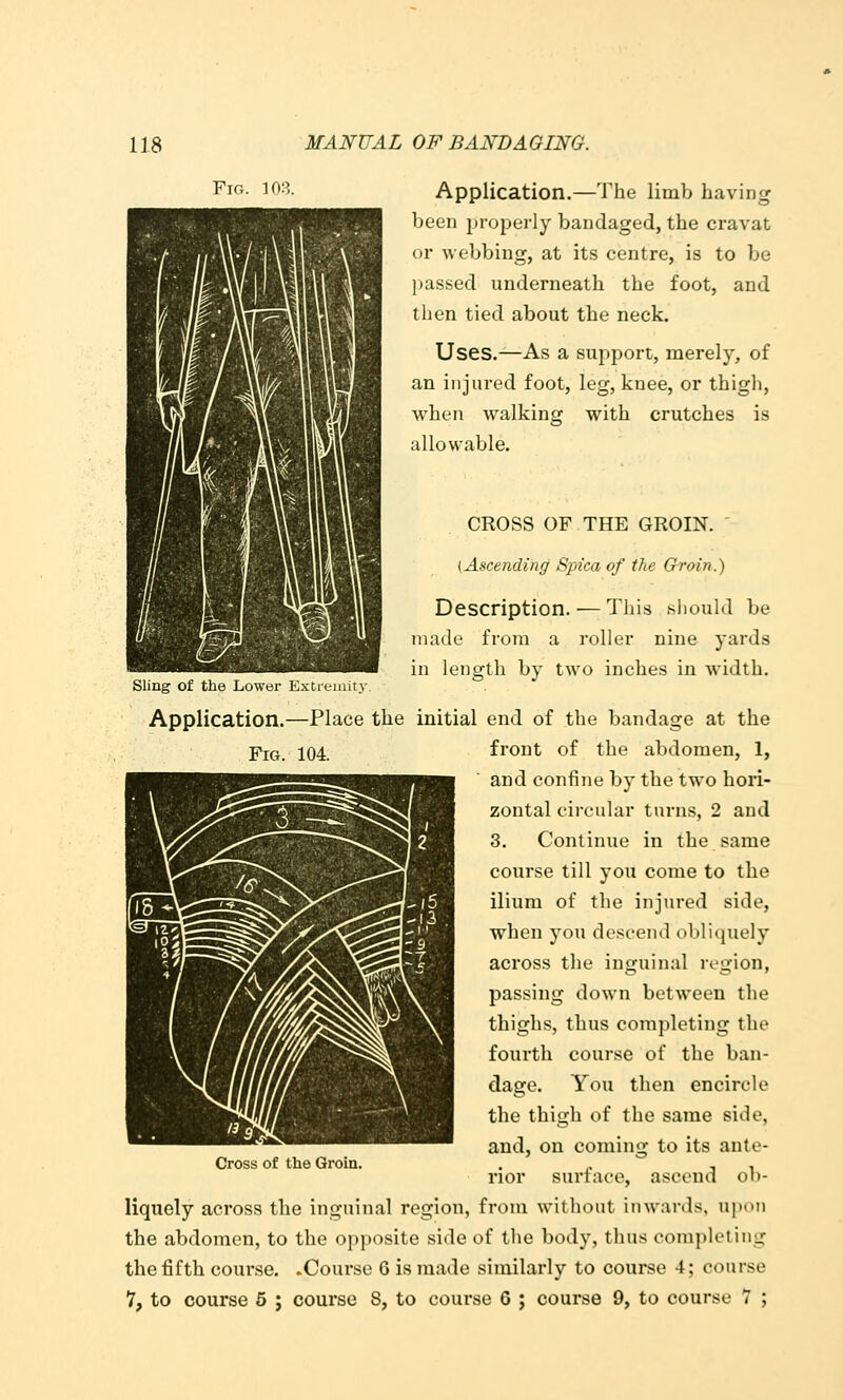 Ficx. lori. Application.—The limb Laving been properly bandaged, the cravat or webbing, at its centre, is to be passed underneath the foot, and then tied about the neck. Uses.—As a support, merely, of an injured foot, leg, knee, or thigh, when w^alking with crutches is allowable. CROSS OF THE GROIN. ' (Ascending Spica of the Groin.) Description. — This should be made from a roller nine yards in length by two inches in width. Sling of the Lower Extremity. Application.—Place the initial end of the bandage at the Fig. 104. front of the abdomen, 1, and confine by the two hori- zontal circular turns, 2 and 3. Continue in the same course till you come to the ilium of the injured side, when you descend obliquely across the inguinal region, passing down between the thighs, thus completing the fourth course of the ban- dage. You then encircle the thigh of the same side, and, on coming to its ante- rior surface, ascend ob- liquely across the inguinal region, from without inwards, upon the abdomen, to the opposite side of the body, thus completing the fifth course. .Course 6 is made similarly to course 4; course 7, to course 5 ; course 8, to course 6 ; course 9, to course 7 ; Cross of the Groin.