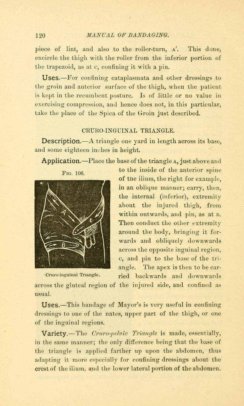 piece of lint, and also to the roller-turn, a'. This done, encircle the thigh with the roller from the inferior portion of the trapezoid, as at c, confining it with a pin. Uses.—For confining cataplasmata and other dressings to the groin and anterior surface of the thigh, Avhen the patient is kept in the recumbent posture. Is of little or no value in exercising compression, and hence does not, in this particular, take the place of the Spica of the Groin just described. CRURO-INGUINAL TRIANGLE. Description.—A triangle one yard in length across its base, and some eighteen inches in height. Application.—Place the base of the triangle a, just above and ^ .|.„ to the inside of the anterior spine of tJie ilium, the right for example, in an oblique manner; carry, then, the internal (inferior), extremity about the injured thigh, from within outwards, and pin, as at b. Then conduct the other extremity around the body, bringing it foi'- wards and obliquely downwards across the opposite inguinal region, c, and pin to the base of the tri- angle. The apex is then to be car- ■Cruro-iuguinai Triangle. ^\q^ backwards and downwai'ds across the gluteal region of the injured side, and confined as usual. Uses.—This bandage of Mayor's is very useful in confining dressings to one of the nates, upper part of the thigh, or one of the inguinal regions. Variety.—The Crxt.ro-pe.lvic Triangle is made, essentially, in the same manner; the only difference being that the base of the triangle is aii])lied farther up upon the abdomen, thus adapting it more especially for confining dressings about the crest of the ilium, and tlie lower lateral portion of the abdomen.