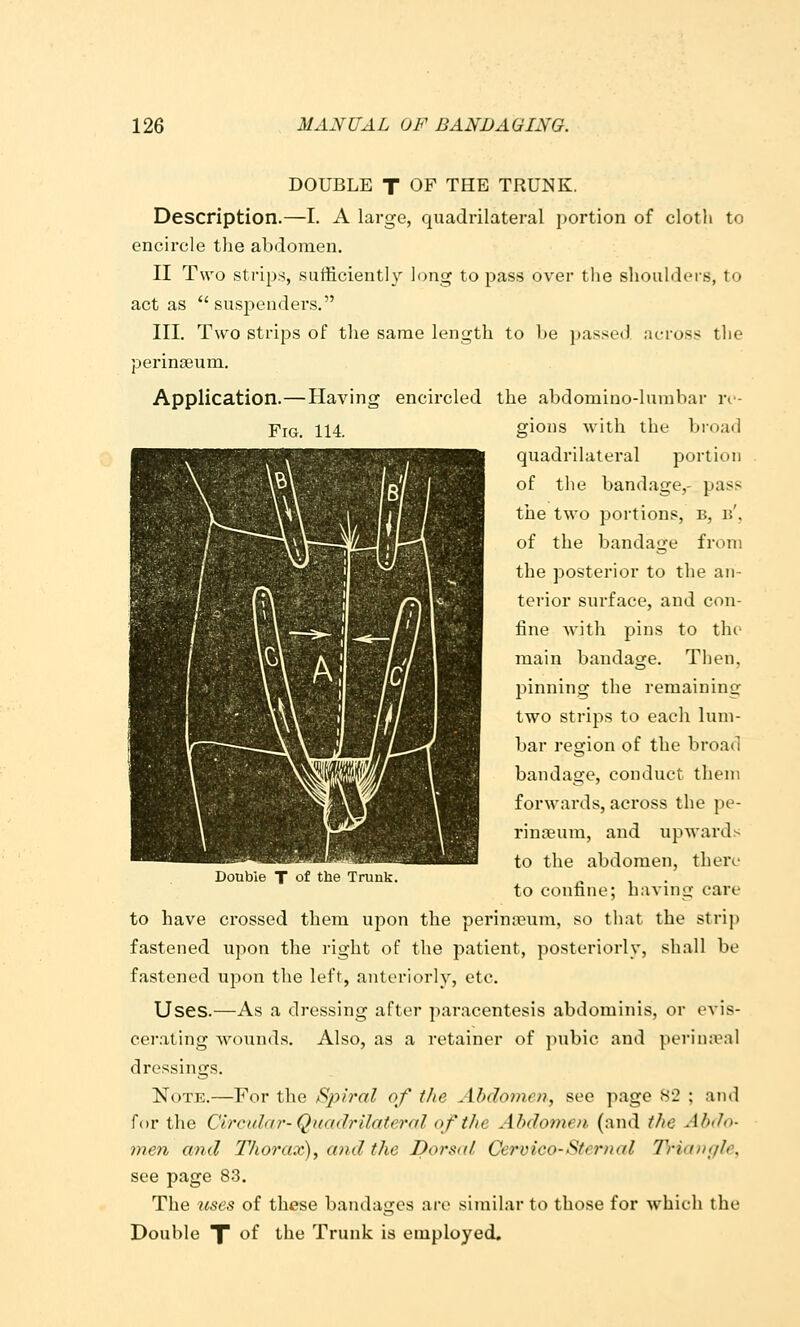 DOUBLE T OF THE TRUNK. Description.—I. A large, quadrilateral portion of cloth to encircle the abdomen. II Two strips, sufficiently long to pass over the shoulders, to act as  suspenders. III. Two strips of the same length to l)e passed across the perinseum. Application.—Having encircled the abdomino-lunibar n- FiG. 114. gions witli the bioail quadrilateral portion of the bandage,- pass the two portions, b, n', of the bandage from the posterior to the an- terior surface, and con- fine with pins to thi- main bandage. Then, pinning the remaining two strips to each lum- bar region of the broad bandage, conduct them forwards, across the pe- rina?um, and upwards to the abdomen, there- to confine; having care to have crossed them upon the perintfum, so that the strip fastened upon the right of the patient, posteriorly, shall be fastened upon the left, anteriorly, etc. Uses.—As a dressing after paracentesis abdominis, or ovis- cei'ating wounds. Also, as a retainer of juibic and periiKval dressings. Note.—For the Spiral of the Abdomen, see page S'2 ; and for the Circular-Quadrilateral of the Abdomen (and the Abdo- men and Thorax), and the Dorsal Cervico-Sternal Triangle, see page 83. The uses of these bandages are similar to those for which the Double TT of the Trunk is employed. Double T of the Trunk.