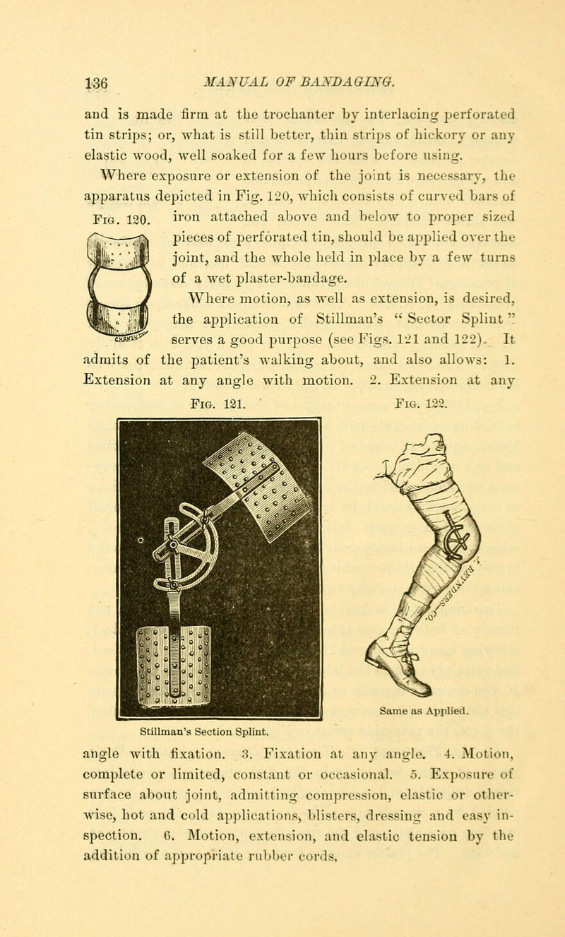 and is made firm at the trochanter by interlacing perforated tin strips; or, what is still better, thin strips of hickory or any elastic wood, well soaked for a few hours before nsing. Where exposure or extension of the joint is necessary, the apparatus depicted in Fig. 120, which consists of curved bars of Fig. 120. i^on attached above and below to proper sized pieces of jDerforated tin, should be applied over the joint, and the whole held in place by a few turns of a wet plaster-bandage. Where motion, as well as extension, is desired, the application of Stillman's  Sector Splint  serves a good jiurpose (see Figs. I'Jl and 122), It admits of the patient's walking about, and also allows: 1. Extension at any angle with motion. 2. Extension at any Fig. 121. Fig. 122. Same as Applied. Stillman's Section Splint. angle with fixation. 3. Fixation at any angle. 4. Motion, complete or limited, constant or occasional. 5. Exposure of surface about joint, admitting compression, clastic or other- wise, hot and cold applicationS|, blisters, dressing and easy in- spection. 6. Motion, extension, and elastic tension by the addition of appropriate rubber cords,