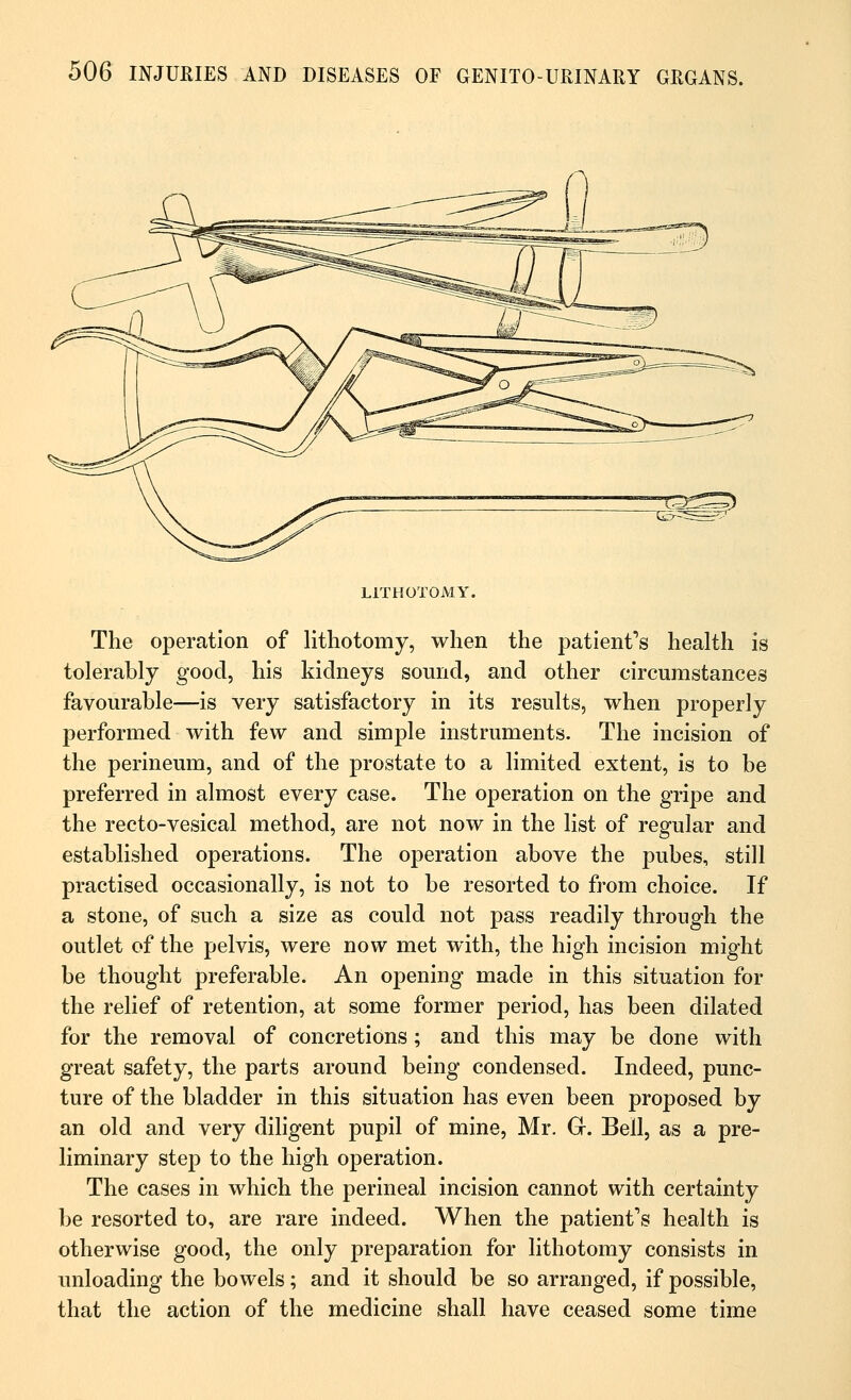 LITHOTOMY. The operation of lithotomy, when the patient's health is tolerably good, his kidneys sonnd, and other circumstances favourable—is very satisfactory in its results, when properly performed with few and simple instruments. The incision of the perineum, and of the prostate to a limited extent, is to be preferred in almost every case. The operation on the gripe and the recto-vesical method, are not now in the list of regular and established operations. The operation above the pubes, still practised occasionally, is not to be resorted to from choice. If a stone, of such a size as could not pass readily through the outlet of the pelvis, were now met with, the high incision might be thought preferable. An opening made in this situation for the relief of retention, at some former period, has been dilated for the removal of concretions ; and this may be done with great safety, the parts around being condensed. Indeed, punc- ture of the bladder in this situation has even been proposed by an old and very diligent pupil of mine, Mr. Gr. Bell, as a pre- liminary step to the high operation. The cases in which the perineal incision cannot with certainty be resorted to, are rare indeed. When the patient's health is otherwise good, the only preparation for lithotomy consists in unloading the bowels; and it should be so arranged, if possible, that the action of the medicine shall have ceased some time