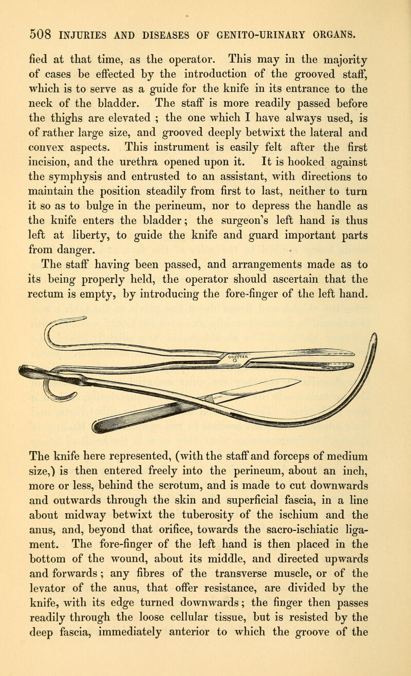 fled at that time, as the operator. This may in the majority of cases be effected by the introduction of the grooved staff, which is to serve as a guide for the knife in its entrance to the neck of the bladder. The staff is more readily passed before the thighs are elevated ; the one which I have always used, is of rather large size, and grooved deeply betwixt the lateral and convex aspects. This instrument is easily felt after the first incision, and the urethra opened upon it. It is hooked against the symphysis and entrusted to an assistant, with directions to maintain the position steadily from first to last, neither to turn it so as to bulge in the perineum, nor to depress the handle as the knife enters the bladder; the surgeon's left hand is thus left at liberty, to guide the knife and guard important parts from danger. The staff having been passed, and arrangements made as to its being properly held, the operator should ascertain that the rectum is empty, by introducing the fore-finger of the left hand. The knife here represented, (with the staff and forceps of medium size,) is then entered freely into the perineum, about an inch, more or less, behind the scrotum, and is made to cut downwards and outwards through the skin and superficial fascia, in a line about midway betwixt the tuberosity of the ischium and the anus, and, beyond that orifice, towards the sacro-ischiatic liga- ment. The fore-finger of the left hand is then placed in the bottom of the wound, about its middle, and directed upwards and forwards ; any fibres of the transverse muscle, or of the levator of the anus, that offer resistance, are divided by the knife, with its edge turned downwards; the finger then passes readily through the loose cellular tissue, but is resisted by the deep fascia, immediately anterior to which the groove of the
