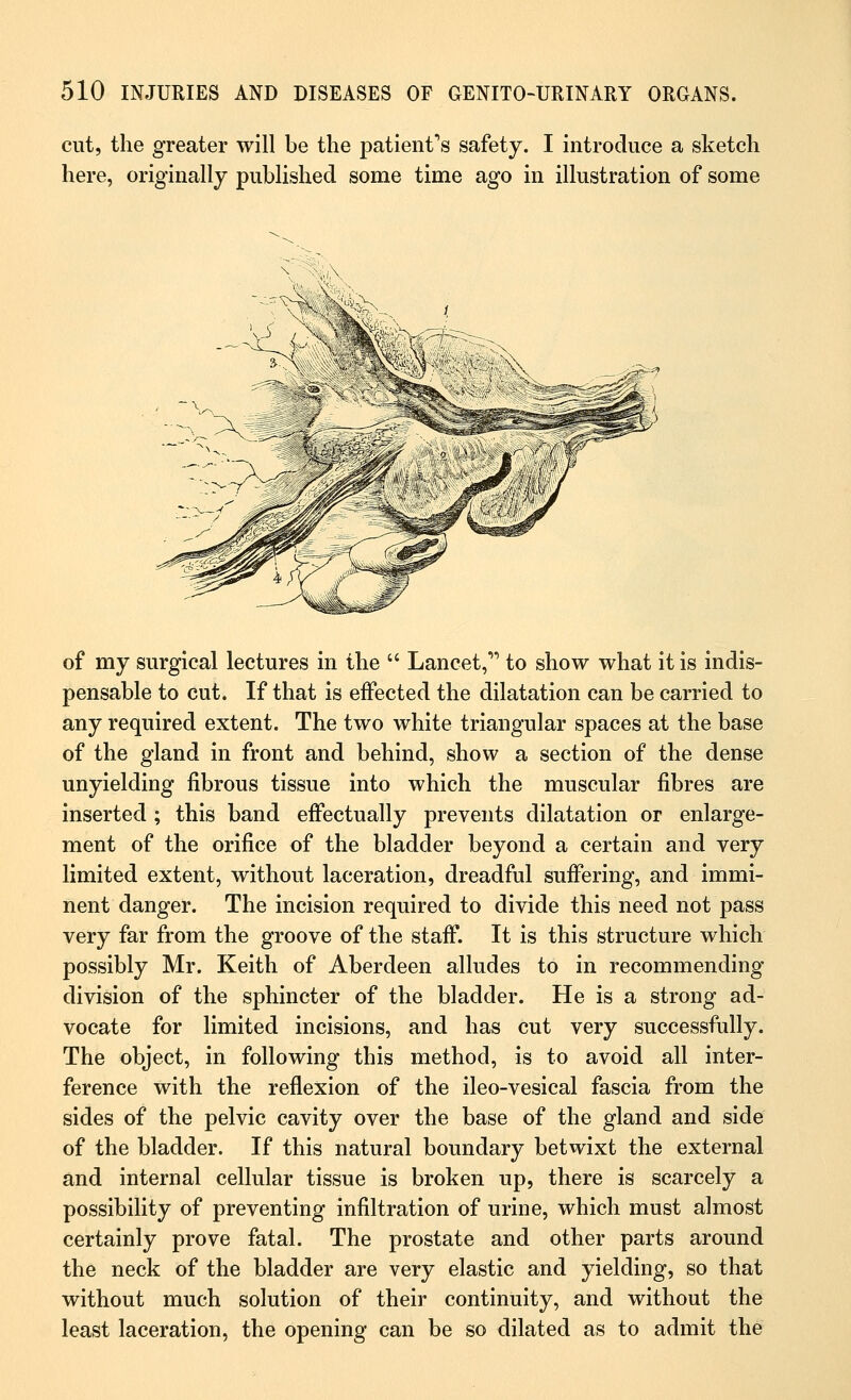 cut, the greater will be the patient's safety. I introduce a sketch here, originally published some time ago in illustration of some of my surgical lectures in the  Lancet, to show what it is indis- pensable to cut. If that is effected the dilatation can be carried to any required extent. The two white triangular spaces at the base of the gland in front and behind, show a section of the dense unyielding fibrous tissue into which the muscular fibres are inserted ; this band effectually prevents dilatation or enlarge- ment of the orifice of the bladder beyond a certain and very limited extent, without laceration, dreadful suffering, and immi- nent danger. The incision required to divide this need not pass very far from the groove of the staff. It is this structure which possibly Mr. Keith of Aberdeen alludes to in recommending division of the sphincter of the bladder. He is a strong ad- vocate for limited incisions, and has cut very successfully. The object, in following this method, is to avoid all inter- ference with the reflexion of the ileo-vesical fascia from the sides of the pelvic cavity over the base of the gland and side of the bladder. If this natural boundary betwixt the external and internal cellular tissue is broken up, there is scarcely a possibility of preventing infiltration of urine, which must almost certainly prove fatal. The prostate and other parts around the neck of the bladder are very elastic and yielding, so that without much solution of their continuity, and without the least laceration, the opening can be so dilated as to admit the