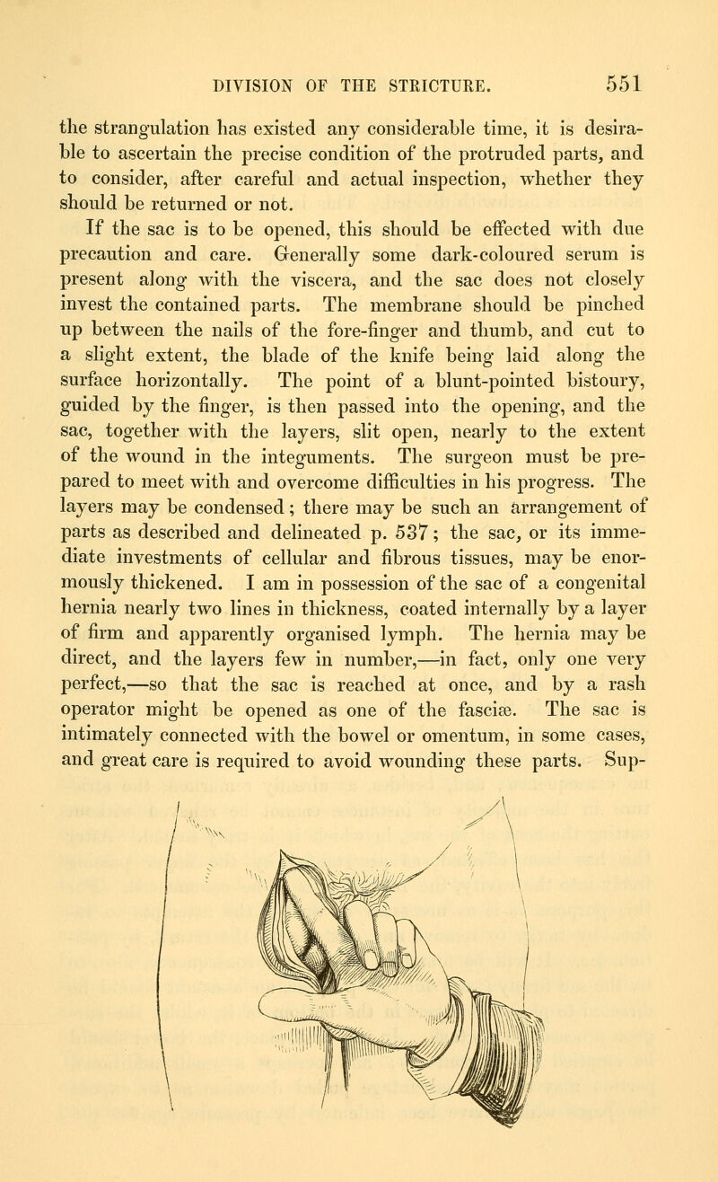 the strangulation has existed any considerable time, it is desira- ble to ascertain the precise condition of the protruded parts, and to consider, after careful and actual inspection, whether they should be returned or not. If the sac is to be opened, this should be effected with due precaution and care. Generally some dark-coloured serum is present along with the viscera, and the sac does not closely invest the contained parts. The membrane should be pinched up between the nails of the fore-finger and thumb, and cut to a slight extent, the blade of the knife being laid along the surface horizontally. The point of a blunt-pointed bistoury, guided by the finger, is then passed into the opening, and the sac, together with the layers, slit open, nearly to the extent of the wound in the integuments. The surgeon must be pre- pared to meet with and overcome difficulties in his progress. The layers may be condensed; there may be such an arrangement of parts as described and delineated p. 537; the sac, or its imme- diate investments of cellular and fibrous tissues, may be enor- mously thickened. I am in possession of the sac of a congenital hernia nearly two lines in thickness, coated internally by a layer of firm and apparently organised lymph. The hernia may be direct, and the layers few in number,—in fact, only one very perfect,—so that the sac is reached at once, and by a rash operator might be opened as one of the fasciae. The sac is intimately connected with the bowel or omentum, in some cases, and great care is required to avoid wounding these parts. Sup-