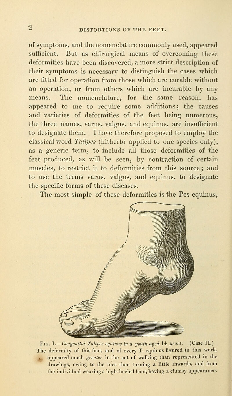 of symptoms, and the nomenclature commonly used, appeared sufficient. But as chirurgical means of overcoming these deformities have been discovered, a more strict description of their symptoms is necessary to distinguish the cases which are fitted for operation from those which are curable without an operation, or from others which are incurable by any means. The nomenclature, for the same reason, has appeared to me to require some additions; the causes and varieties of deformities of the feet being numerous, the three names, varus, valgus, and equinus, are insufficient to designate them. I have therefore proposed to employ the classical word Talipes (hitherto applied to one species only), as a generic term, to include all those deformities of the feet produced, as will be seen, by contraction of certain muscles, to restrict it to deformities from this source; and to use the terms varus, valgus, and equinus, to designate the specific forms of these diseases. The most simple of these deformities is the Pes equinus, Fig. I.— Congenital Talipes equinus in a youth aged 14 years. (Case II.) The deformity of this foot, and of every T. equinus figured in this work, , appeared much greater in the act of walking than represented in the drawings, owing to the toes then turning a little inwards, and from the individual wearing a high-heeled boot, having a clumsy appearance.