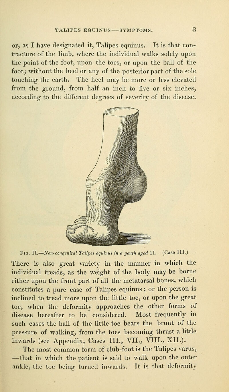 or, as I have designated it, Talipes equinus. It is that con- tracture of the limb, where the individual walks solely upon the point of the foot, upon the toes, or upon the ball of the foot; without the heel or any of the posterior part of the sole touching the earth. The heel may be more or less elevated from the ground, from half an inch to five or six inches, according to the different degrees of severity of the disease. Fig. II.—Non-congenital Talipes equinus in a youth aged 11. (Case III.) There is also great variety in the manner in which the individual treads, as the weight of the body may be borne either upon the front part of all the metatarsal bones, which constitutes a pure case of Talipes equinus; or the person is inclined to tread more upon the little toe, or upon the great toe, when the deformity approaches the other forms of disease hereafter to be considered. Most frequently in such cases the ball of the little toe bears the brunt of the pressure of walking, from the toes becoming thrust a little inwards (see Appendix, Cases III., VII., VIII., XII.). The most common form of club-foot is the Talipes varus, —that in which the patient is said to walk upon the outer ankle, the toe being turned inwards. It is that deformity