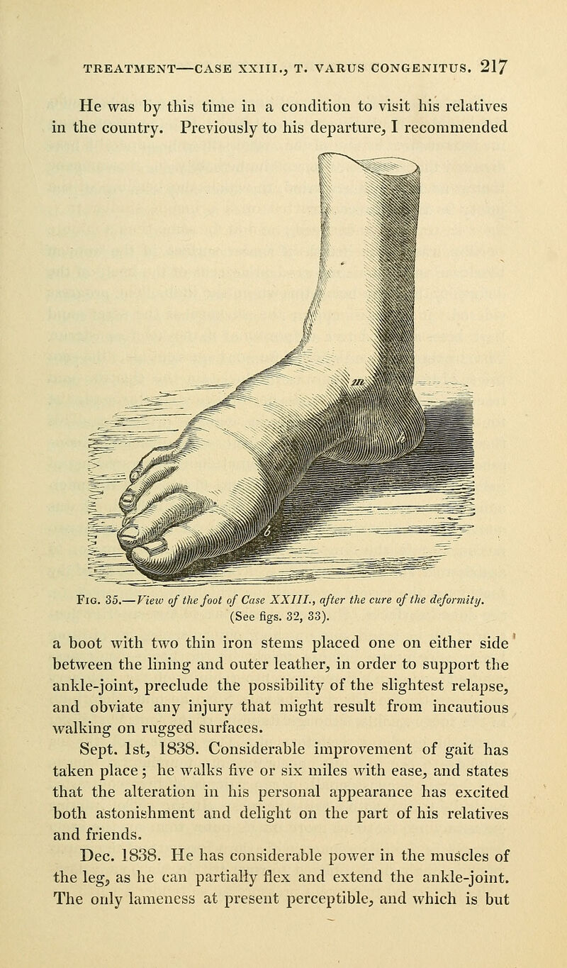 He was by this time in a condition to visit his relatives in the country. Previously to his departure, I recommended Fig. 35.— View of the foot of Case XXIII., after the cure of the deformity. (See figs. 32, 33). a boot with two thin iron stems placed one on either side between the lining and outer leather, in order to support the ankle-joint, preclude the possibility of the slightest relapse, and obviate any injury that might result from incautious walking on rugged surfaces. Sept. 1st, 1838. Considerable improvement of gait has taken place; he walks five or six miles with ease, and states that the alteration in his personal appearance has excited both astonishment and delight on the part of his relatives and friends. Dec. 1838. He has considerable power in the muscles of the leg, as he can partially flex and extend the ankle-joint. The only lameness at present perceptible, and which is but