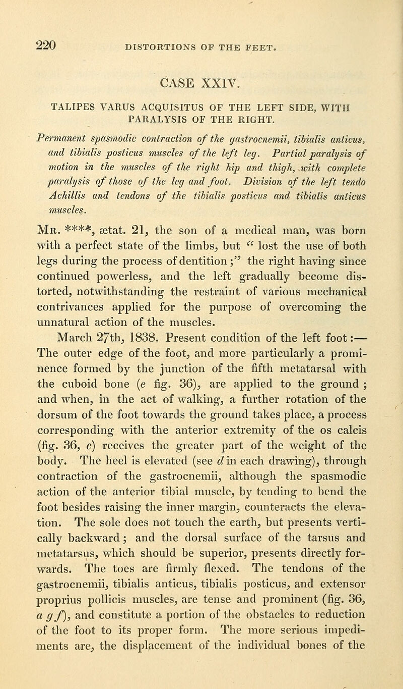 CASE XXIV. TALIPES VARUS ACQUISITUS OF THE LEFT SIDE, WITH PARALYSIS OF THE RIGHT. Permanent spasmodic contraction of the gastrocnemii, tibialis anticus, and tibialis posticus muscles of the left leg. Partial paralysis of motion in the muscles of the right hip and thigh, .with complete paralysis of those of the leg and foot. Division of the left tendo Achillis and tendons of the tibialis posticus and tibialis anticus muscles. Mr. ****5 setat. 21, the son of a medical man, was born with a perfect state of the limbs, but  lost the use of both legs during the process of dentition; the right having since continued powerless, and the left gradually become dis- torted, notwithstanding the restraint of various mechanical contrivances applied for the purpose of overcoming the unnatural action of the muscles. March 27th, 1838. Present condition of the left foot:— The outer edge of the foot, and more particularly a promi- nence formed by the junction of the fifth metatarsal with the cuboid bone (e fig. 36), are applied to the ground ; and when, in the act of walking, a further rotation of the dorsum of the foot towards the ground takes place, a process corresponding with the anterior extremity of the os calcis (fig. 36, c) receives the greater part of the weight of the body. The heel is elevated (see d in each drawing), through contraction of the gastrocnemii, although the spasmodic action of the anterior tibial muscle, by tending to bend the foot besides raising the inner margin, counteracts the eleva- tion. The sole does not touch the earth, but presents verti- cally backward; and the dorsal surface of the tarsus and metatarsus, which should be superior, presents directly for- wards. The toes are firmly flexed. The tendons of the gastrocnemii, tibialis anticus, tibialis posticus, and extensor proprius pollicis muscles, are tense and prominent (fig. 36, a g f), and constitute a portion of the obstacles to reduction of the foot to its proper form. The more serious impedi- ments are, the displacement of the individual bones of the
