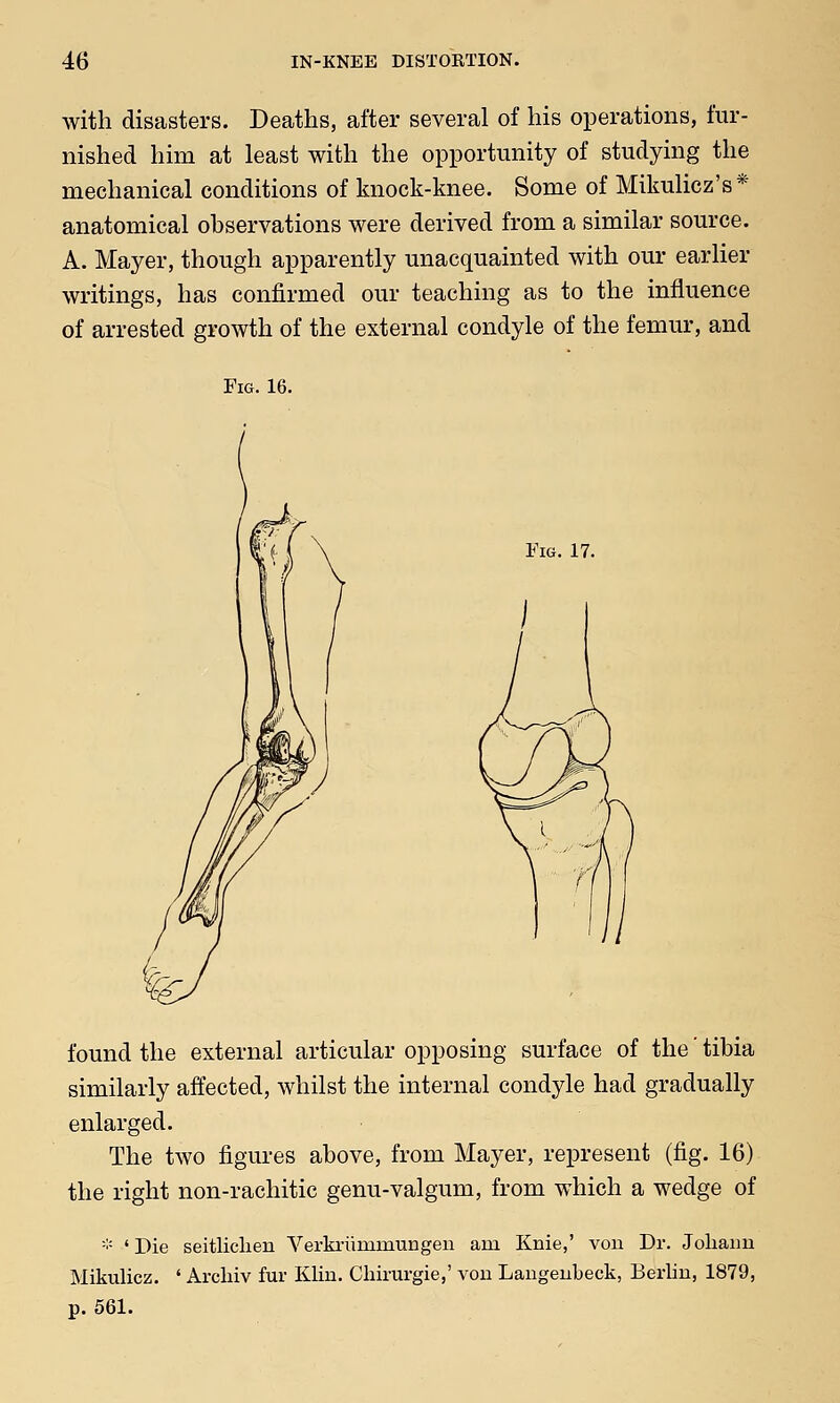 with disasters. Deaths, after several of his operations, fur- nished him at least with the opportunity of studying the mechanical conditions of knock-knee. Some of Mikulicz's* anatomical observations were derived from a similar source. A. Mayer, though apparently unacquainted with our earlier writings, has confirmed our teaching as to the influence of arrested growth of the external condyle of the femur, and Fig. 16. Fig. 17. found the external articular opposing surface of the tibia similarly affected, whilst the internal condyle had gradually enlarged. The two figures above, from Mayer, represent (fig. 16) the right non-rachitic genu-valgum, from which a wedge of * ' Die seitliclien Verkrumrnungen am Knie,' von Dr. Joliaim Mikulicz. ' Archiv fur Klin. Cliirurgie,' von Langenbeck, Berlin, 1879, p. 561.