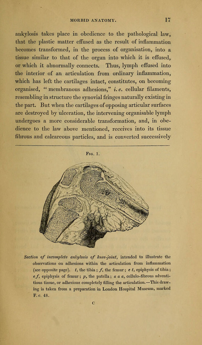 ankylosis takes place in obedience to the pathological law, that the plastic matter effused as the result of inflammation becomes transformed, in the process of organisation, into a tissue similar to that of the organ into which it is effused, or which it abnormally connects. Thus, lymph effused into the interior of an articulation from ordinary inflammation, which has left the cartilages intact, constitutes, on becoming organised,  membranous adhesions, i. e. cellular filaments, resembling in structure the synovial fringes naturally existing in the part. But when the cartilages of opposing articular surfaces are destroyed by ulceration, the intervening organisable lymph undergoes a more considerable transformation, and, in obe- dience to the law above mentioned, receives into its tissue fibrous and calcareous particles, and is converted successively Ftg. 1. Section of incomplete ankylosis of knee-joint, intended to illustrate the observations on adhesions within the articulation from inflammation (see opposite page), t, the tibia ; /, the femur; e t, epiphysis of tibia; ef, epiphysis of femur; p, the patella; a a a, cellulo-fibrous adventi- tious tissue, or adhesions completely filling the articulation.—This draw- ing is taken from a preparation in London Hospital Museum, marked F.c, 48.