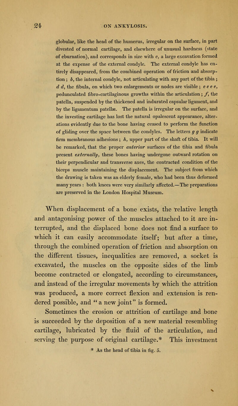 globular, like the head of the humerus, irregular on the surface, in part divested of normal cartilage, and elsewhere of unusual hardness (state of eburnation), Eind corresponds in size with c, a large excavation formed at the expense of the external condyle. The external condyle has en- tirely disappeared, from the combined operation of friction and absorp- tion ; b, the internal condyle, not articulating with any part of the tibia ; d d, the fibula, on which two enlargements or nodes are visible ; e eee, pedunculated fibro-cartUaginous growths within the articulation; y, the patella, suspended by the thickened and indurated capsular ligament, and by the ligamentum patellae. The patella is irregular on the surface, and the investing cartilage has lost the natural opalescent appearance, alter- ations evidently due to the bone having ceased to perform the function of gliding over the space between the condyles. The letters g g indicate firm membranous adhesions ; h, upper part of the shaft of tibia. It will be remarked, that the proper anterior surfaces of the tibia and fibula present externally, these bones having undergone outward rotation on their perpendicular and transverse axes, the contracted condition of the biceps muscle maintaining the displacement. The subject from which the drawing is taken was an elderly female, who had been thus deformed many years : both knees were very similarly affected.—The preparations are preserved in the London Hospital Museum. AVlien displacement of a bone exists, the relative length and antagonising power of the muscles attached to it are in- terrupted, and the displaced bone does not find a surface to which it can easily accommodate itself; but after a time, through the combined operation of friction and absorption on the different tissues, inequalities are removed, a socket is excavated, the muscles on the opposite sides of the limb become contracted or elongated, according to circumstances, and instead of the irregular movements by which the attrition was produced, a more correct flexion and extension is ren- dered possible, and a new joint is formed. Sometimes the erosion or attrition of cartilage and bone is succeeded by the deposition of a new material resembling cartilage, lubricated by the fluid of the articulation, and serving the purpose of original cartilage.* This investment * As the head of tibia in fig. 5.