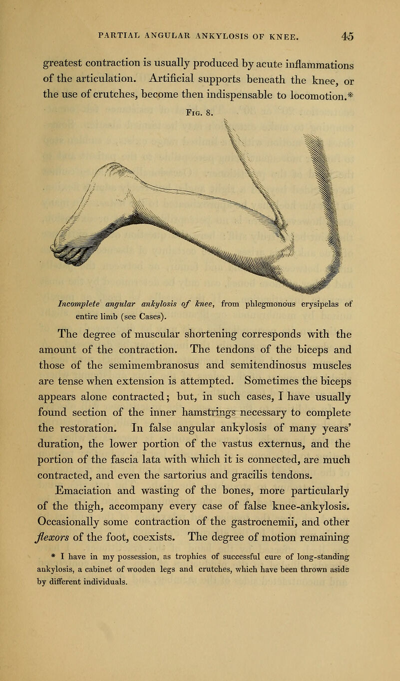 greatest contraction is usually produced by acute inflammations of the articulation. Artificial supports beneath the knee or the use of crutches, become then indispensable to locomotion.* Fig. 8. Incomplete angular ankylosis of knee, from phlegmonous erysipelas of entire limb (see Cases). The degree of muscular shortening corresponds with the amount of the contraction. The tendons of the biceps and those of the semimembranosus and semitendinosus muscles are tense when extension is attempted. Sometimes the biceps appears alone contracted; but, in such cases, I have usually found section of the inner hamstrings necessary to complete the restoration. In false angular ankylosis of many years' duration, the lower portion of the vastus externus, and the portion of the fascia lata with which it is connected, are much contracted, and even the sartorius and gracilis tendons. Emaciation and wasting of the bones, more particularly of the thigh, accompany every case of false knee-ankylosis. Occasionally some contraction of the gastrocnemii, and other fiexors of the foot, coexists. The degree of motion remaining * I have in my possession, as trophies of successful cure of long-standing ankylosis, a cabinet of wooden legs and crutches, which have been thrown asids by different individuals.