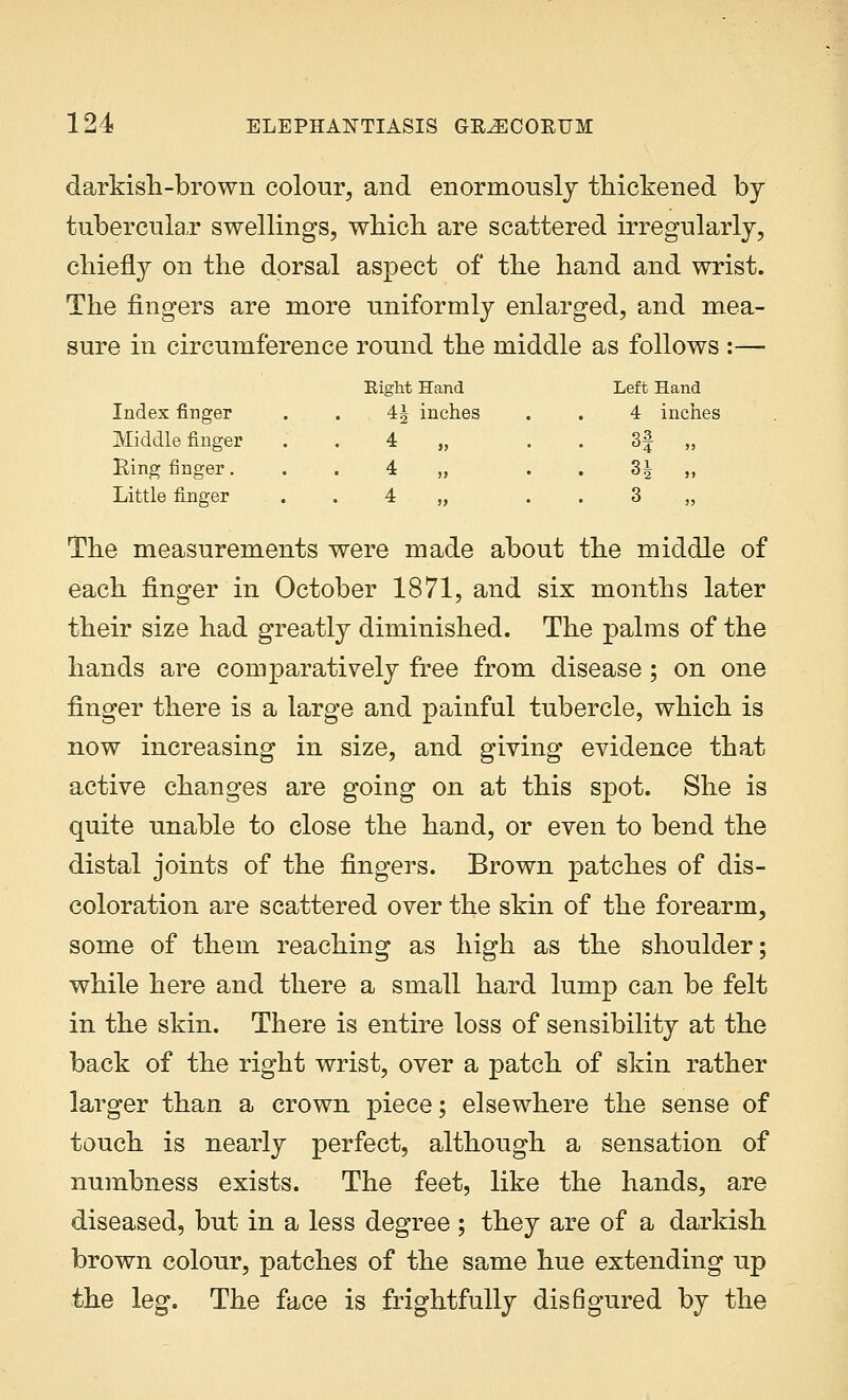 darkish-brown colour, and enormously thickened by tubercular swellings, which are scattered irregularly, chiefly on the dorsal aspect of the hand and wrist. The fingers are more uniformly enlarged, and mea- sure in circumference round the middle as follows :— Index finger Eight Hand 4J inches Left Hand 4 inches Middle finger King finger. Little finger . 4 „ 4 „ 4 „ ^3 4 >> 3 „ The measurements were made about the middle of each finger in October 1871, and six months later their size had greatly diminished. The palms of the hands are comparatively free from disease; on one finger there is a large and painful tubercle, which is now increasing in size, and giving evidence that active changes are going on at this spot. She is quite unable to close the hand, or even to bend the distal joints of the fingers. Brown patches of dis- coloration are scattered over the skin of the forearm, some of them reaching as high as the shoulder; while here and there a small hard lump can be felt in the skin. There is entire loss of sensibility at the back of the right wrist, over a patch of skin rather larger than a crown piece; elsewhere the sense of touch is nearly perfect, although a sensation of numbness exists. The feet, like the hands, are diseased, but in a less degree; they are of a darkish brown colour, patches of the same hue extending up the leg. The face is frightfully disfigured by the