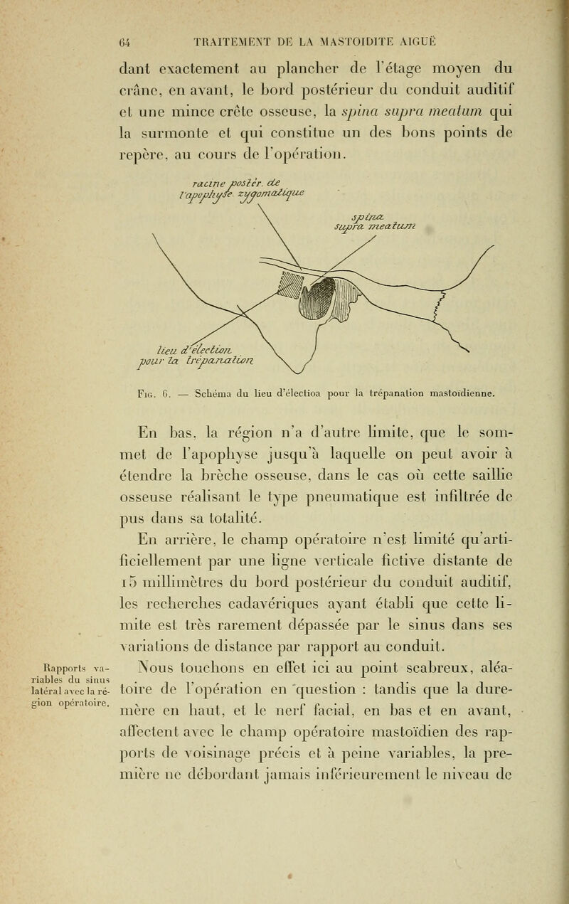 dant exactement au plancher de l'étage moyen du crâne, en avant, le bord postérieur du conduit auditif et une mince crête osseuse, la spina supra meatam qui la surmonte et qui constitue un des bons points de repère, au cours de l'opération. racine posler. cLe lapophuse zuooma2ùjfi jpirut supro- TJieaîum lieu d'éleclioiz voui- la IréparuzlLon FiG. C. — Schéma du lieu d'électioa pour la trépanation mastoïdienne. En bas. la région n'a d'autre limite, que le som- met de l'apophyse jusqu'à laquelle on peut avoir à étendre la brèche osseuse, dans le cas oii cette sailhe osseuse réalisant le type pneumatique est infiltrée de pus dans sa totalité. En arrière, le champ opératoire n'est limité qu'arti- ficiellement par une ligne Acrticale fictive distante de i5 millimètres du bord postérieur du conduit auditif, les recherches cadavériques ayant établi que cette li- mite est très rarement dépassée j)ar le sinus dans ses variations de distance par rapport au conduit. Rapports va- Nous touchous cu cffct ici au point scabreux, aléa- riables du sinus .,,,,. . ,. , , latéral av. c la ré- tou'c dc 1 Opération en question : tandis que la dure- ffion opératoire. ^ iiii c c • ^ i ■ • mère en liaut, et le nerf lacial, en i3as et en avant, affectent avec le champ opératoire mastoïdien des rap- ports de voisinage précis et à peine variables, la pre- mière ne débordant jamais inférieurcmcnt le niveau de