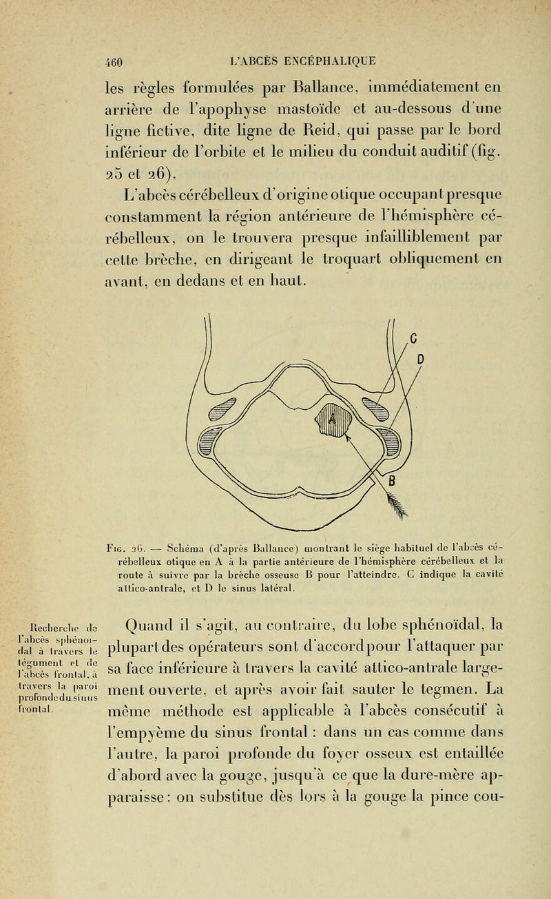 les règles formulées par Ballance. immédiatement en arrière de l'apophyse mastoïde et au-dessous d une ligne fictive, dite ligne de Reid, qui passe parle bord inférieur de l'orbite et le milieu du conduit auditif (fig. 25 et 26). L'abcès cérébelleux d'origine otique occupant presque constamment la région antérieure de l'hémisphère cé- rébelleux, on le trouvera presque infailliblement par cette brèche, en dirigeant le troquart obliquement en avant, en dedans et en haut. Fig. 2G. — Schéma (d'après BalUmce) montrant le siège habituel do l'abcès co- rébelleux otique en A à la partie antérieure de l'hémisphère cérébelleux et la route à suivre par la brèche osseuse B pour l'atteindre. C indique la cavité altico-antrale, et D le sinus latéral. Ilcclicrchc do l'abcès sphcnoi- dal à travers le tégument ot de ] abcès iront al, à travers la [)aroi prolondcdu sinus Irontal. Quand il s'agit, au contraire, du lobe sphénoïdal, la plupart des opérateurs sont d'accordpour lattaqucr par sa face inférieure à ti^avers la cavité attico-antrale large- ment ouverte, et après avoir fait sauter le tegmen. La même méthode est applicable à l'abcès consécutif à l'empyème du sinus frontal : dans un cas comme dans l'autre, la paroi profonde du foyer osseux est entaillée d'abord avec la gouge, jusqu'à ce que la dure-mère ap- paraisse: on substitue dès lors à la gouge la pince cou-