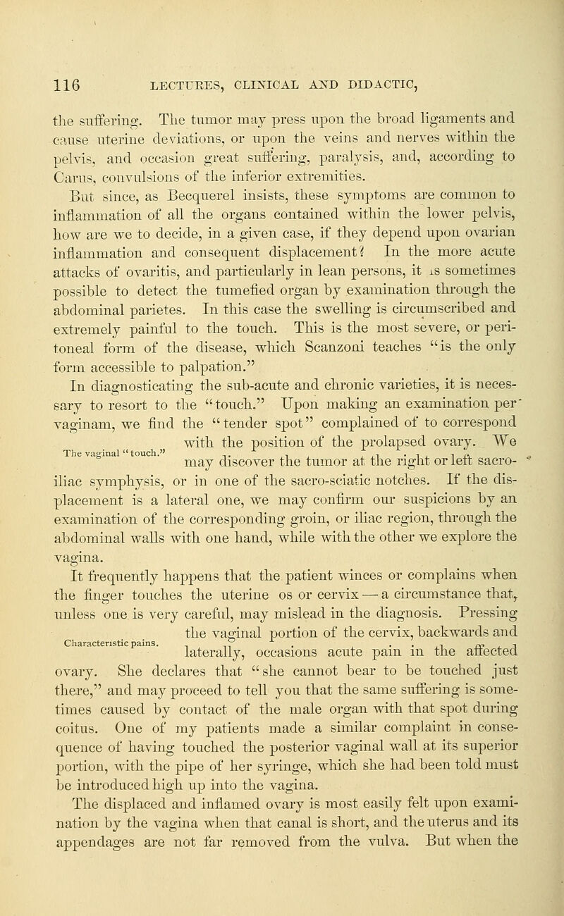 the suffering. The tumor may press upon, the broad ligaments and cause uterine deviations, or upon the veins and nerves within the pelvis, and occasion great snifering, paralysis, and, according to Cams, convulsions of the inferior extremities. But since, as Becquerel insists, these symptoms are common to inflammation of all the organs contained within the lower pelvis, how are we to decide, in a given case, if they depend upon ovarian inflammation and consequent displacement? In the more acute attacks of ovaritis, and particularly in lean persons, it is sometimes possible to detect the tumefied organ by examination through the abdominal parietes. In this case the swelling is circumscribed and extremely painful to the touch. This is the most severe, or peri- toneal form of the disease, which Scanzoni teaches is the only form accessible to palpation. In diagnosticating the sub-acute and chronic varieties, it is neces- sary to resort to the touch. Upon making an examination per* vaginam, we find the tender spot complained of to correspond with the position of the prolapsed ovary. We e vagina ouc . ^^_^ discovcr the tumor at the right or left sacro- iliac symphysis, or in one of the sacro-sciatic notches. If the dis- placement is a lateral one, we may confirm our suspicions by an examination of the corresponding groin, or iliac region, through the abdominal walls with one hand, while with the other we explore the vagina. It frequently happens that the patient winces or complains when the finger touches the uterine os or cervix — a circumstance thaty unless one is very careful, may mislead in the diagnosis. Pressing the vaginal portion of the cervix, backwards and Characteristic pains. ^ , ■ • i_i £0 j. j laterally, occasions acute pain m tne ailectea ovary. She declares that she cannot bear to be touched just there, and may proceed to tell you that the same suffering is some- times caused by contact of the male organ with that spot during coitus. One of my patients made a similar complaint in conse- quence of having touched the posterior vaginal wall at its superior portion, with the pipe of her syringe, which she had been told must be introduced high up into the vagina. The displaced and inflamed ovary is most easily felt upon exami- nation by the vagina when that canal is short, and the uterus and its appendages are not far removed from the vulva. But when the