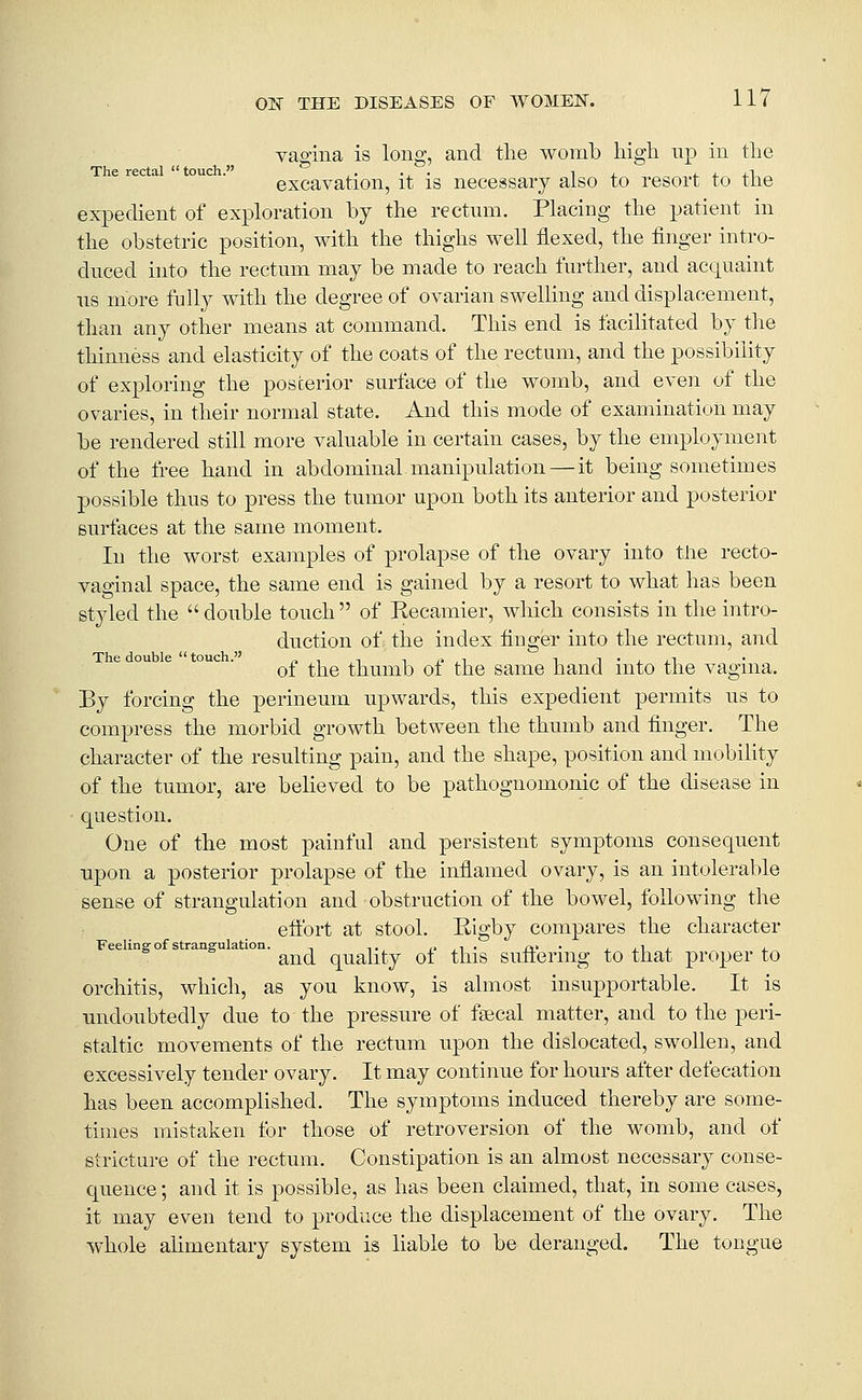 vamna is long, and the womb high np in the The rectal  touch. ,. .^. i, t. 4. ^.^ ^ excavation, it is necessary also to resort to tJie exj^eclient of exploration by the rectum. Placing the patient in the obstetric position, with the thighs well flexed, the finger intro- duced into the rectum may be made to reach further, and acquaint us more fully with the degree of ovarian swelling and displacement, than any other means at command. This end is facilitated by the thinness and elasticity of the coats of the rectum, and the possibility of exploring the posterior surface of the womb, and even of the ovaries, in their normal state. And this mode of examination may be rendered still more valuable in certain cases, by the employment of the free hand in abdominal manipulation — it being sometimes possible thus to press the tumor upon both its anterior and posterior surfaces at the same moment. In the worst examples of prolapse of the ovary into tlie recto- vaginal space, the same end is gained by a resort to what has been styled the  double touch  of Recamier, which consists in the intro- duction of the index finger into the rectum, and of the thumb of the same hand into the vagina. By forcing the perineum upwards, this expedient permits us to compress the morbid growth between the thumb and finger. The character of the resulting pain, and the shape, position and mobihty of the tumor, are believed to be pathognomonic of the disease in question. One of the most painful and persistent symptoms consequent upon a posterior prolapse of the inflamed ovary, is an intolerable sense of strangulation and obstruction of the bowel, following the efibrt at stool. Rigby compares the character Feehngo strangu ation. ^^^ quality of this sufteriiig to that proper to orchitis, which, as you know, is almost insupportable. It is undoubtedly due to the pressure of faecal matter, and to the peri- staltic movements of the rectum upon the dislocated, swollen, and excessively tender ovary. It may continue for hours after defecation has been accomplished. The symptoms induced thereby are some- times mistaken for those of retroversion of the womb, and of stricture of the rectum. Constipation is an almost necessary conse- quence ; and it is possible, as has been claimed, that, in some cases, it may even tend to produce the displacement of the ovary. The whole alimentary system is liable to be deranged. The tongue