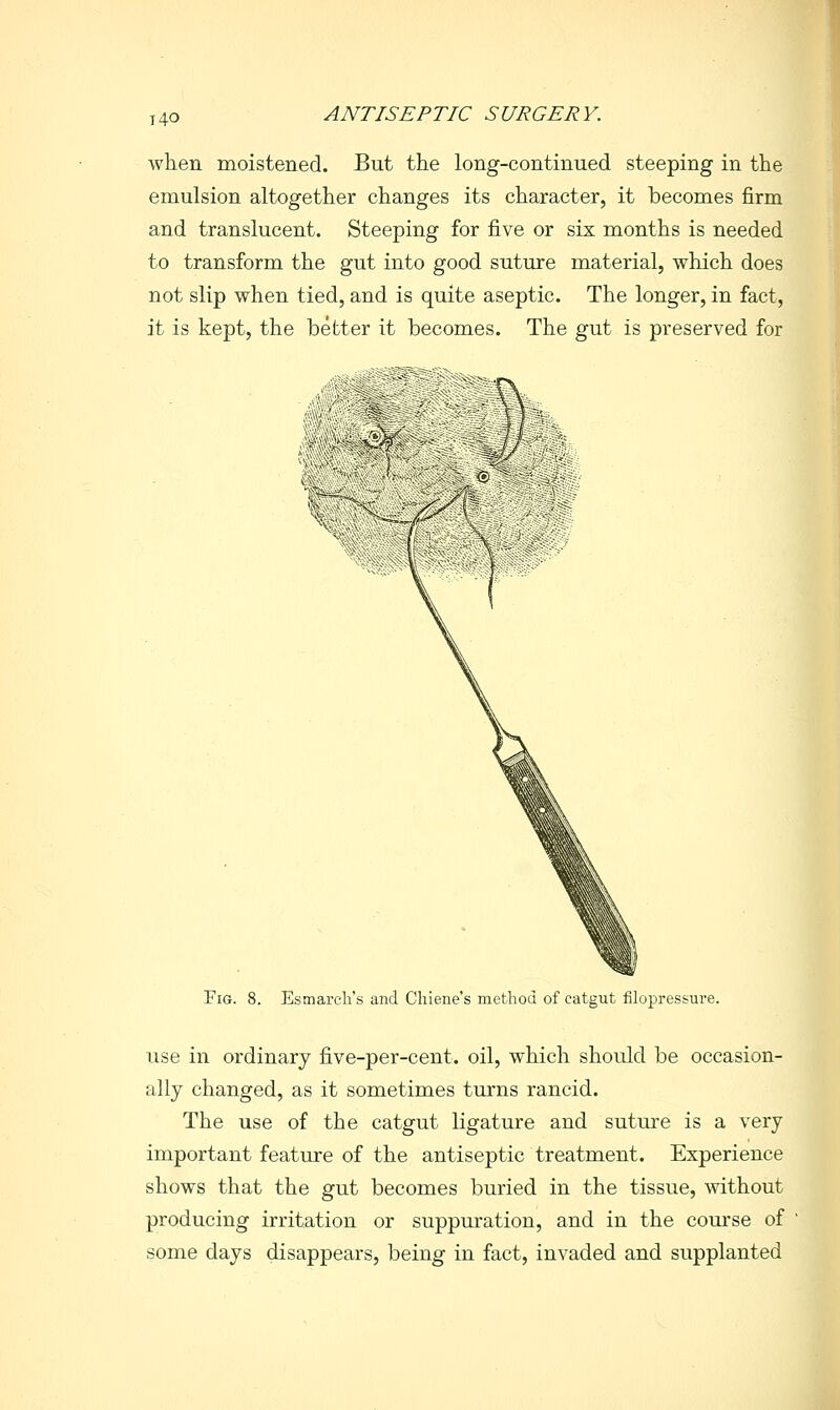 t4o when moistened. But the long-continued steeping in the emulsion altogether changes its character, it becomes firm and translucent. Steeping for five or six months is needed to transform the gut into good suture material, which does not slip when tied, and is quite aseptic. The longer, in fact, it is kept, the better it becomes. The gut is preserved for Fig. 8. Esmarch's and Chiene's method of catgut filopressure. use in ordinary five-per-cent. oil, which should be occasion- ally changed, as it sometimes turns rancid. The use of the catgut ligature and suture is a very important feature of the antiseptic treatment. Experience shows that the gut becomes buried in the tissue, Avithout producing irritation or suppuration, and in the course of ' some days disappears, being in fact, invaded and supplanted