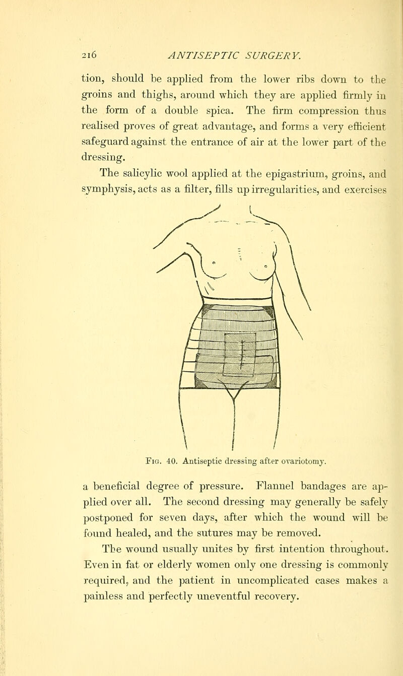 tion, should be applied from the lower ribs down to the groins and thighs, around which they are applied firmly in the form of a double spica. The firm compression thus realised proves of great advantage, and forms a very efficient safeguard against the entrance of air at the lower part of the dressing. The salicylic wool applied at the epigastrium, groins, and symphysis, acts as a filter, fills up irregularities, and exercises I Fig. 40. Antiseptic dressing after orariotomy. a beneficial degree of pressure. Flannel bandages are ap- plied over all. The second dressing may generally be safely postponed for seven days, after which the wound will be found healed, and the sutures may be removed. The wound usually unites by first intention throughout. Even in fat or elderly women only one dressing is commonly required, and the patient in uncomplicated cases makes a painless and perfectly uneventful recovery.