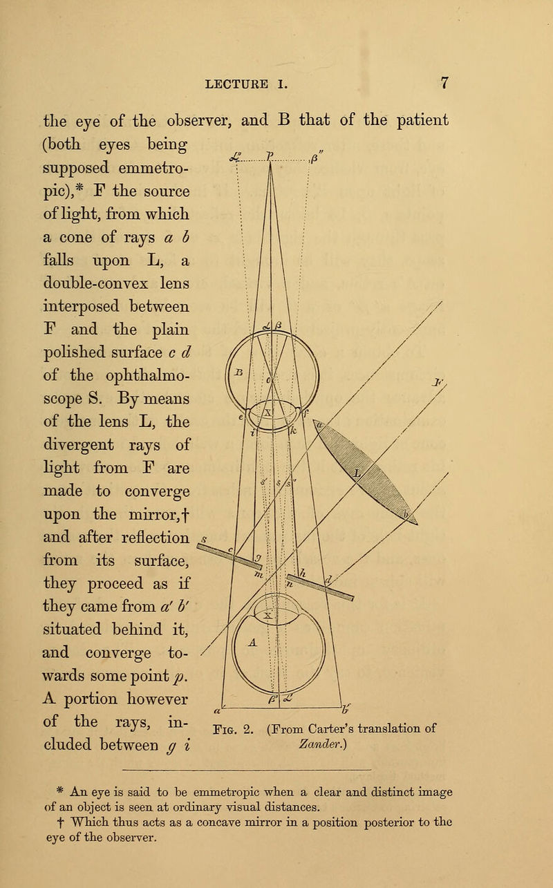 the eye of the observer, and B that of the patient (both eyes being supposed emmetro- pic),* F the source of light, from which a cone of rays a b falls upon L, a double-convex lens interposed between F and the plain polished surface c d of the ophthalmo- scope S. By means of the lens L, the divergent rays of light from F are made to converge upon the mirror, f and after reflection from its surface, they proceed as if they came from a' b' situated behind it, and converge to- wards some pointy. A portion however of the rays, in- cluded between g i Fig. 2. (From Carter's translation of Zander.) * An eye is said to be emmetropic when a clear and distinct image of an object is seen at ordinary visual distances. f Which thus acts as a concave mirror in a position posterior to the eye of the observer.