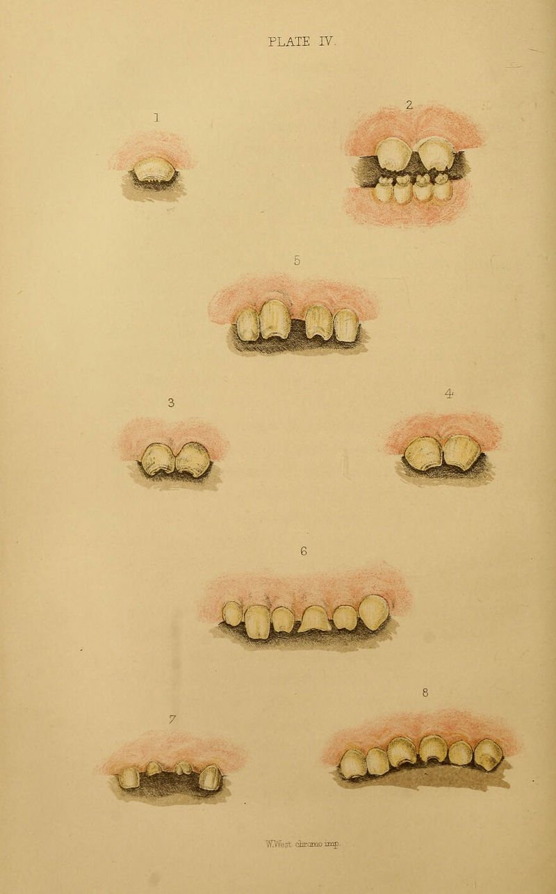 PLATE IV. /{*%. mromoraif-
