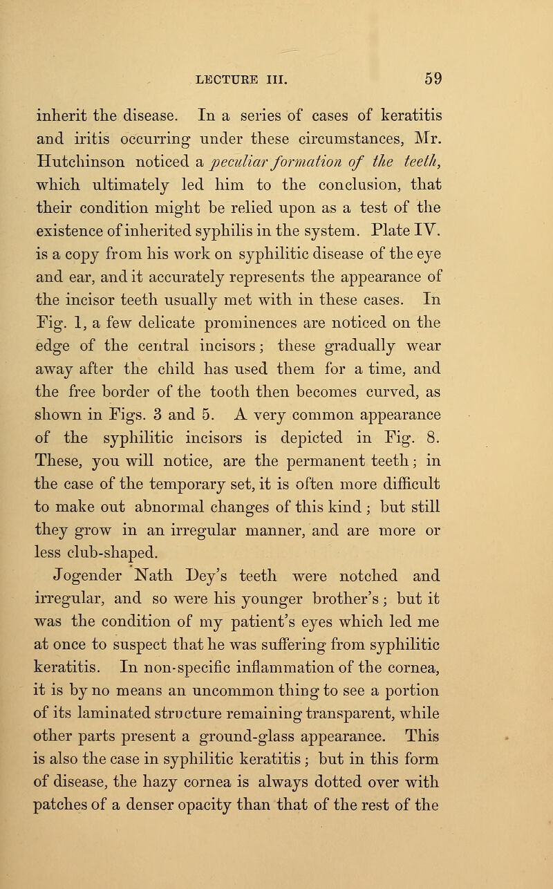 inherit the disease. In a series of cases of keratitis and iritis occurring under these circumstances, Mr. Hutchinson noticed a peculiar formation of the teeth, which ultimately led him to the conclusion, that their condition might be relied upon as a test of the existence of inherited syphilis in the system. Plate IV. is a copy from his work on syphilitic disease of the eye and ear, and it accurately represents the appearance of the incisor teeth usually met with in these cases. In Fig. 1, a few delicate prominences are noticed on the edge of the central incisors; these gradually wear away after the child has used them for a time, and the free border of the tooth then becomes curved, as shown in Figs. 3 and 5. A very common appearance of the syphilitic incisors is depicted in Fig. 8. These, you will notice, are the permanent teeth; in the case of the temporary set, it is often more difficult to make out abnormal changes of this kind ; but still they grow in an irregular manner, and are more or less club-shaped. Jogender Nath Dey's teeth were notched and irregular, and so were his younger brother's; but it was the condition of my patient's eyes which led me at once to suspect that he was suffering from syphilitic keratitis. In non-specific inflammation of the cornea, it is by no means an uncommon thing to see a portion of its laminated structure remaining transparent, while other parts present a ground-glass appearance. This is also the case in syphilitic keratitis; but in this form of disease, the hazy cornea is always dotted over with patches of a denser opacity than that of the rest of the