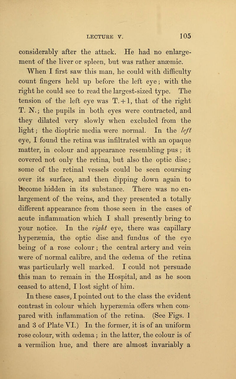 considerably after the attack. He had no enlarge- ment of the liver or spleen, but was rather ansemic. When I first saw this man, he could with difficulty count fingers held up before the left eye; with the right he could see to read the largest-sized type. The tension of the left eye was T. + 1, that of the right T. N.; the pupils in both eyes were contracted, and they dilated very slowly when excluded from the light; the dioptric media were normal. In the left eye, I found the retina was infiltrated with an opaque matter, in colour and appearance resembling pus ; it covered not only the retina, but also the optic disc; some of the retinal vessels could be seen coursing over its surface, and then dipping down again to become hidden in its substance. There was no en- largement of the veins, and they presented a totally different appearance from those seen in the cases of acute inflammation which I shall presently bring to your notice. In the rigid eye, there was capillary hyperemia, the optic disc and fundus of the eye being of a rose colour; the central artery and vein were of normal calibre, and the oedema of the retina was particularly well marked. I could not persuade this man to remain in the Hospital, and as he soon ceased to attend, I lost sight of him. In these cases, I pointed out to the class the evident contrast in colour which hyperemia offers when com- pared with inflammation of the retina. (See Figs. 1 and 3 of Plate VI.) In the former, it is of an uniform rose colour, with oedema; in the latter, the colour is of a vermilion hue, and there are almost invariably a
