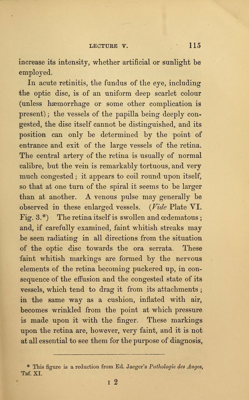 increase its intensity, whether artificial or sunlight be employed. In acute retinitis, the fundus of the eye, including the optic disc, is of an uniform deep scarlet colour (unless hemorrhage or some other complication is present); the vessels of the papilla being deeply con- gested, the disc itself cannot be distinguished, and its position can only be determined by the point of entrance and exit of the large vessels of the retina. The central artery of the retina is usually of normal calibre, but the vein is remarkably tortuous, and very much congested; it appears to coil round upon itself, so that at one turn of the spiral it seems to be larger than at another. A venous pulse may generally be observed in these enlarged vessels. {Vide Plate YI. Fig. 3.*) The retina itself is swollen and cedematous; and, if carefully examined, faint whitish streaks may be seen radiating in all directions from the situation of the optic disc towards the ora serrata. These faint whitish markings are formed by the nervous elements of the retina becoming puckered up, in con- sequence of the effusion and the congested state of its vessels, which tend to drag it from its attachments ; in the same way as a cushion, inflated with air, becomes wrinkled from the point at which pressure is made upon it with the finger. These markings upon the retina are, however, very faint, and it is not at all essential to see them for the purpose of diagnosis, * This figure is a reduction from Ed. Jaeger's Pathologie des Auges, Taf. XL I 2