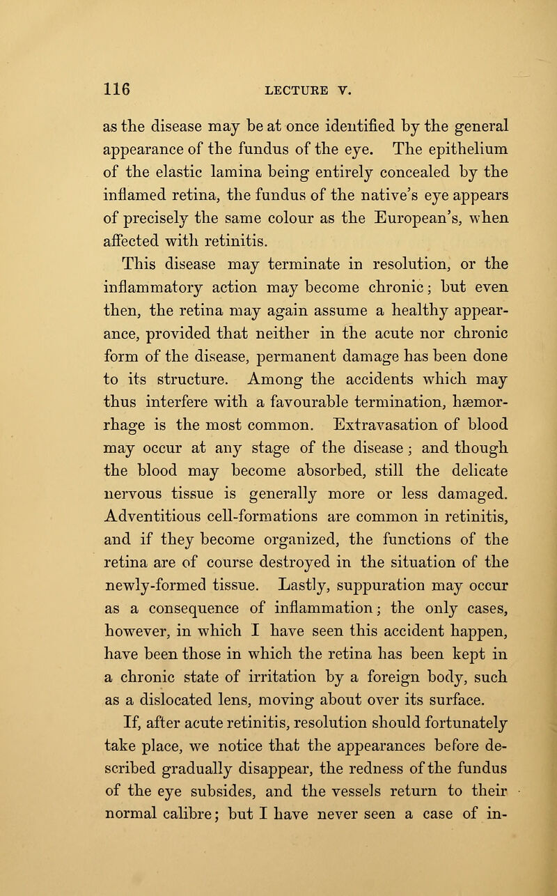 as the disease may be at once identified by the general appearance of the fundns of the eye. The epithelium of the elastic lamina being entirely concealed by the inflamed retina, the fundus of the native's eye appears of precisely the same colour as the European's, when affected with retinitis. This disease may terminate in resolution, or the inflammatory action may become chronic; but even then, the retina may again assume a healthy appear- ance, provided that neither in the acute nor chronic form of the disease, permanent damage has been done to its structure. Among the accidents which may thus interfere with a favourable termination, haemor- rhage is the most common. Extravasation of blood may occur at any stage of the disease; and though the blood may become absorbed, still the delicate nervous tissue is generally more or less damaged. Adventitious cell-formations are common in retinitis, and if they become organized, the functions of the retina are of course destroyed in the situation of the newly-formed tissue. Lastly, suppuration may occur as a consequence of inflammation; the only cases, however, in which I have seen this accident happen, have been those in which the retina has been kept in a chronic state of irritation by a foreign body, such as a dislocated lens, moving about over its surface. If, after acute retinitis, resolution should fortunately take place, we notice that the appearances before de- scribed gradually disappear, the redness of the fundus of the eye subsides, and the vessels return to their normal calibre; but I have never seen a case of in-