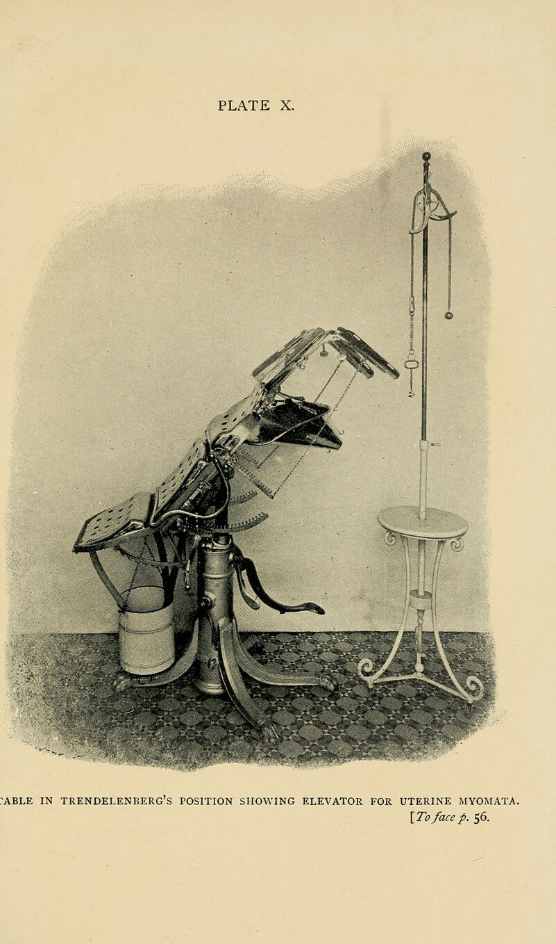 ABLE IN TRENDELENBERG's POSITION SHOWING ELEVATOR FOR UTERINE MYOMATA. [To face p. 56.