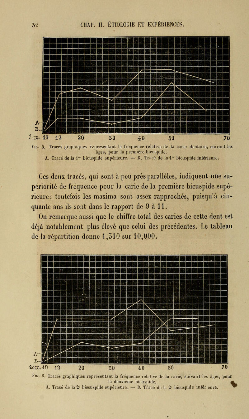 '..;s< 10 12 Fig. 5. Tracés graphiques représentant la fréquence relative de la carie dentaire, suivant les âges, pour la première bicuspide. A. Tracé delà 1 bicuspide supérieure. — B. Tracé de la lre bicuspide inférieure. Ces deux tracés, qui sont à peu près parallèles, indiquent une su- périorité de fréquence pour la carie de la première bicuspide supé- rieure; toutefois les maxima sont assez rapprochés, puisqu'à cin- quante ans ils sont dans le rapport de 9 à H. On remarque aussi que le chiffre total des caries de cette dent est déjà notablement plus élevé que celui des précédentes. Le tableau de la répartition donne 4,510 sur 10,000. &qes. 10 12 20 50 40 50 2e r< jicU: A. Tracé de la 2e biscu^pide supérieure. — B. Tracé de la 2 bicuspide inférieure Fig. 6. Tracés graphiques représentant la fréquence relative de la carie, suivant les âges, pour la deuxième bicuspide. *i