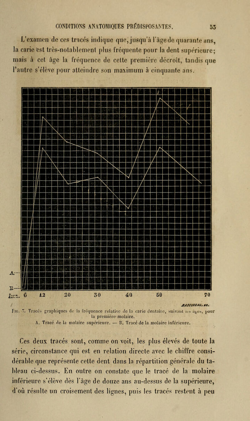 L'examen de ces tracés indique que, jusqu'à l'Age de quarante ans, la carie est très-notablement plus fréquente pour la dent supérieure; mais à cet âge la fréquence de celte première décroît, tandis que l'autre s'élève pour atteindre son maximum à cinquante ans. I ■BB! IBBS IIRII II mua» IIJMI IB HJBBHBI BT™ ■Massas MBI IBB BI1IIHBBB ■bai iM»KS«nani mnmmmmmmmwimi kshbi mmmmmmrâmm Il IMBIli ~BflflflBfl «BBBBBBIfiBI IBBBPIB 1BBBBB S '■■^■■■■^■■■■■■■■■a BBBBBBrJBBBflBBBBBBB BBBB3BBI IBBBBflfll BBB ~flBHBBBfll IHBBB BIM BFIBBBHHHI ffllIUlllUIII II BBBBBBBBBBBBI IBBBBB BBBBBBBBBBBBBBBBBBB BBBHBBBBBBBBfl! BBBBBBBBBBBBBBBBBBfl BBBBBBBBBBHBBBBBHBI «BBBBBBflflBflflBBBBBBB IBBBBiBBBBBBBBBflBBflB ^BBHBHBHBBBBI IBBBBBBBB iBBB BBBBBBBBBBBI IBBB IBHBHBBBBBBBBflBfl IBBBBBBBBBBBBBBBI IZL a. 6 30 50 70 / JJOCUREAU* PS. Fie. 7. Tracés graphiques du la fréquence relative de la carie dentaire, suivant les âge», pour la première molaire. A. Tracé delà molaire supérieure. — B. Tracé de la molaire inférieure. Ces deux tracés sont, comme on voit, les plus élevés de toute la série, circonstance qui est en relation directe avec le chiffre consi- dérable que représente cette dent dans la répartition générale du ta- bleau ci-dessus. En outre on constate que le tracé de la molaire inférieure s'élève dès l'âge de douze ans au-dessus de la supérieure, d'où résulte un croisement des lignes, puis les tracés restent à peu