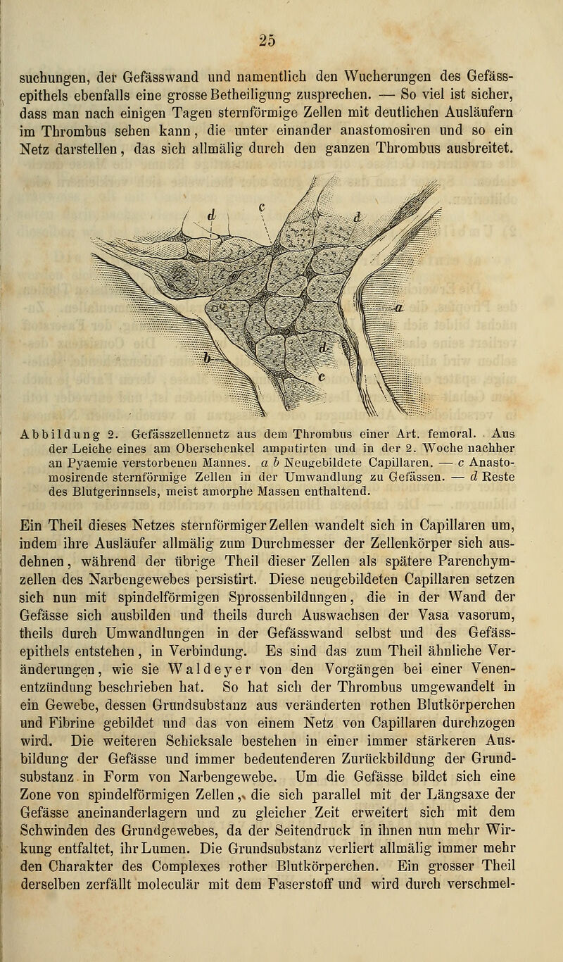 suchungen, der Gefässwand und namentlich den Wucherungen des Gefäss- epithels ebenfalls eine grosse Betheiligung zusprechen. — So viel ist sicher, dass man nach einigen Tagen sternförmige Zellen mit deutlichen Ausläufern im Thrombus sehen kann, die unter einander anastomosiren und so ein Netz darstellen, das sich allmälig durch den ganzen Thrombus ausbreitet. Abbildung 2. Gefässzellenuetz aus dem Thrombus einer Art. femoral. Aus der Leiche eines am Oberschenkel ampntirten und in der 2. Woche nachher an Pyaemie verstorbenen Mannes, a b Neujrebildete Capillaren. — c Anasto- mosirende sternförmige Zellen in der Umwandlung zu Gefässen. — d Reste des Blutgerinnsels, meist amorphe Massen enthaltend. Ein Theil dieses Netzes sternförmiger Zellen wandelt sich in Capillaren um, mdem ihre Ausläufer allmälig zum Durchmesser der Zellenkörper sich aus- dehnen , während der übrige Theil dieser Zellen als spätere Parenchym- zellen des Narbengewebes persistirt. Diese neugebildeten Capillaren setzen sich nun mit spindelförmigen Sprossenbildungen, die in der Wand der Gefässe sich ausbilden und theils durch Auswachsen der Vasa vasorum, theils durch Umwandlungen in der Gefässwand selbst und des Gefäss- epithels entstehen, in Verbindung. Es sind das zum Theil ähnliche Ver- änderungen, wie sie Waldeyer von den Vorgängen bei einer Venen- entzündung beschrieben hat. So hat sich der Thrombus umgewandelt in ein Gewebe, dessen Grundsubstanz aus veränderten rothen Blutkörperchen und Fibrine gebildet und das von einem Netz von Capillaren durchzogen wird. Die weiteren Schicksale bestehen in einer immer stärkeren Aus- bildung der Gefässe und immer bedeutenderen Zurückbildung der Grund- substanz in Form von Narbengewebe. Um die Gefässe bildet sich eine Zone von spindelförmigen Zellen ,> die sich parallel mit der Längsaxe der Gefässe aneinanderlagern und zu gleicher Zeit erweitert sich mit dem Schwinden des Grundgewebes, da der Seitendruck in ihnen nun mehr Wir- kung entfaltet, ihr Lumen. Die Grundsubstanz verliert allmälig immer mehr den Charakter des Compleses rother Blutkörperchen. Ein grosser Theil derselben zerfällt moleculär mit dem Faserstoff und wird durch verschmel-