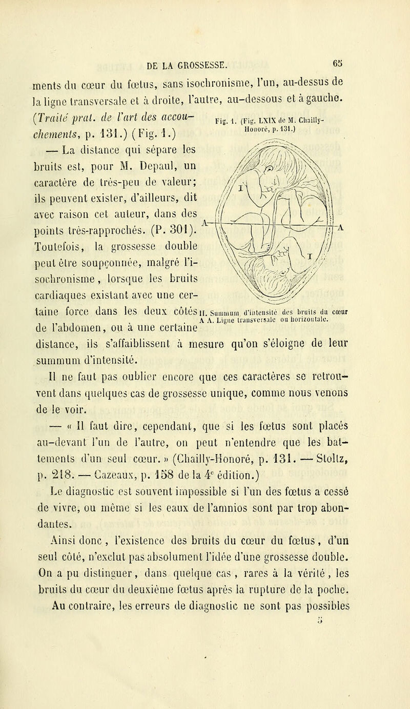 Honoré, p. 131.) ments du cœur du fœUis, sans isochronisme, l'un, au-dessus de la ligne transversale et adroite, l'autre, au-dessous et cà gauche. chements, p. i31.) (Fig. 1.) — La distance qui sépare les bruits est, pour M. Depaul, un caractère de très-peu de valeur; ils peuvent exister, d'ailleurs, dit avec raison cet auteur, dans des points très-rapprocbés. (P. 301). Toutefois, la grossesse double peut être soupçonnée, malgré l'i- socbronisnie, lorsque les bruits cardiaques existant avec une cer- taine force dans les deux côtés h, summum d'intensité dos bruils du cœur A A. Ligue transversale ou liorizoïitalc. de l'abdomen, ou à une certaine distance, ils s'affaiblissent à mesure qu'on s'éloigne de leur summum d'intensité. Il ne faut pas oublier encore que ces caractères se retrou- vent dans quelques cas de grossesse unique, comme nous venons de le voir. — « Il faut dire, cependant, que si les fœtus sont placés au-devant l'un de l'autre, on peut n'entendre que les bat- tements d'un seul cœur. » (Ghailly-Honoré, p. 131. — Stollz, p. 218. — Cazeaux, p. 158 de la 4' édition.) Le diagnostic est souvent impossible si l'un des fœtus a cessé de vivre, ou même si les eaux de l'amnios sont par trop abon- dantes. Ainsi donc , l'existence des bruits du cœur du fœtus, d'un seul côté, n'exclut pas absolument l'idée d'une grossesse double. On a pu distinguer, dans quelque cas, rares à la vérilé , les bruits du cœur du deuxième fœtus après la rupture de la poche. Au contraire, les erreurs de diagnostic ne sont pas possibles