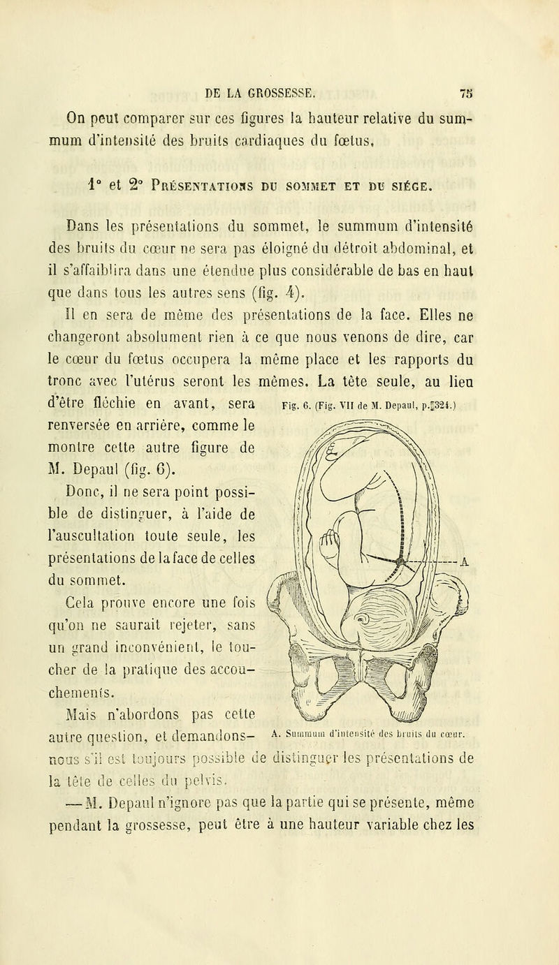 On peut comparer sur ces figures la hauteur relative du sum- mum d'inteusité des bruits cardiaques du fœtus, 1° et 2° Présentatiohs du sommet et diï sîége. Dans les présentations du sommet, le summum d'intensité des bruits du cœur ne sera pas éloigné du détroit abdominal, et il s'affaiblira dans une étendue plus considérable de bas en haut que dans tous les autres sens (fig. 4). Il en sera de même des présentations de la face. Elles ne changeront absolument rien à ce que nous venons de dire, car le cœur du fœtus occupera la même place et les rapports du tronc avec l'utérus seront les mêmes. La tète seule, au lien d'être fléchie en avant, sera Fig. e. (Fig. vu de m. oepaui, p.psi.) renversée en arriére, comme le montre cette autre figure de M. Depaul (fig. G). Donc, il ne sera point possi- ble de distinguer, à l'aide de l'auscultation toute seule, les présentations de la face de celles du sommet. Cela prouve encore une fois qu'on ne saurait rejeter, sans un grand inconvénient, le tou- cher de la pratique des accou- chements. Mais n'abordons pas cette autre question, et demandons- Fioas s'il est toujours possible de distinguer les présentations de la tête de celles du pelvis, — M. Depaul n'ignore pas que la partie qui se présente, même pendant la grossesse, peut être à une hauteur variable chez les