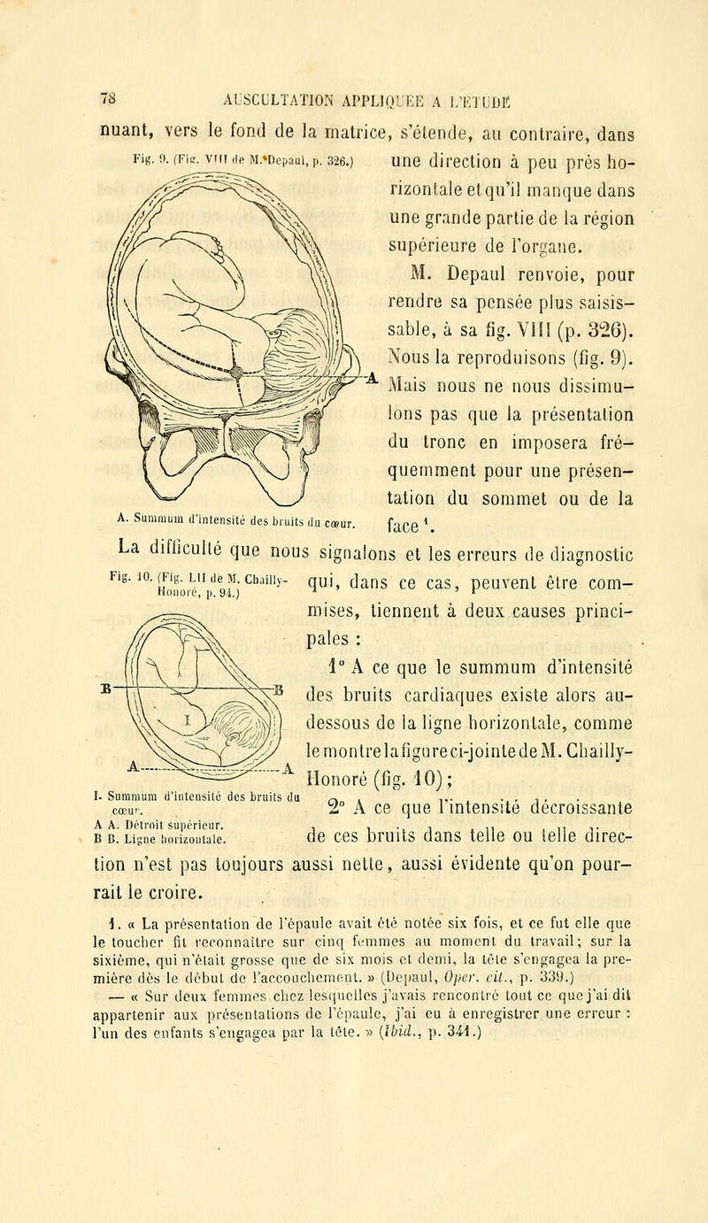 nuant, vers le fond de la matrice, s'élende, au contraire, dans Fig. 9. (Fier, vm (ie M.*Depaui,p. 326.) Une direction à peu près ho- rizontale et qu'il manque dans une grande partie de la région supérieure de l'organe. M. Depaul renvoie, pour rendre sa pensée plus saisis- sable, à sa fig. VIH (p. 326). Nous la reproduisons (fig. 9). '•^ Mais nous ne nous dissimu- lons pas que la présentation du tronc en imposera fré- quemment pour une présen- tation du sommet ou de la face \ A. Summum d'intensité des bruits du cmu Fig. 10. (Fig. LU de M. Cliailly Honoré, p. 94.) La difficulté que nous signalons et les erreurs de diagnostic qui, dans ce cas, peuvent être com- mises, tiennent à deux causes princi- pales : 1 A ce que le summum d'intensité des bruits cardiaques existe alors au- dessous de la ligne horizontale, comme lemonlrelafigureci-jointedeM.Gliailly- Honoré (fig. iO); I. Summum d'intensité des bruits du r\ i n- . . , , , cœur. z° A ce que 1 mtensite décroissante A A. Détroit supérieur. , i -i i i n , m •,• B B. Ligne iiorizontaie. de ces Druits daus telle OU telle direc- tion n'est pas toujours aussi nette, aussi évidente qu'on pour- rait le croire. 1. a La présentation de l'épaule avait été notée six fois, et ce fut elle que le toucher fil reconnaître sur cinq femmes au moment du travail; sur la sixième, qui n'était grosse que de six mois et demi, la tête s'engagea la pre- mière dès le début de l'accoiichement. » (Depaul, Oper. cU., p. 339.) — (c Sur deux femmes chez lescpielles j'avais rencontré tout ce que j'ai dit appartenir aux présentations de l'épaule, j'ai eu à enregistrer une erreur : l'un des enfants s'engagea par la tête. » {îbid., p. 3U.)