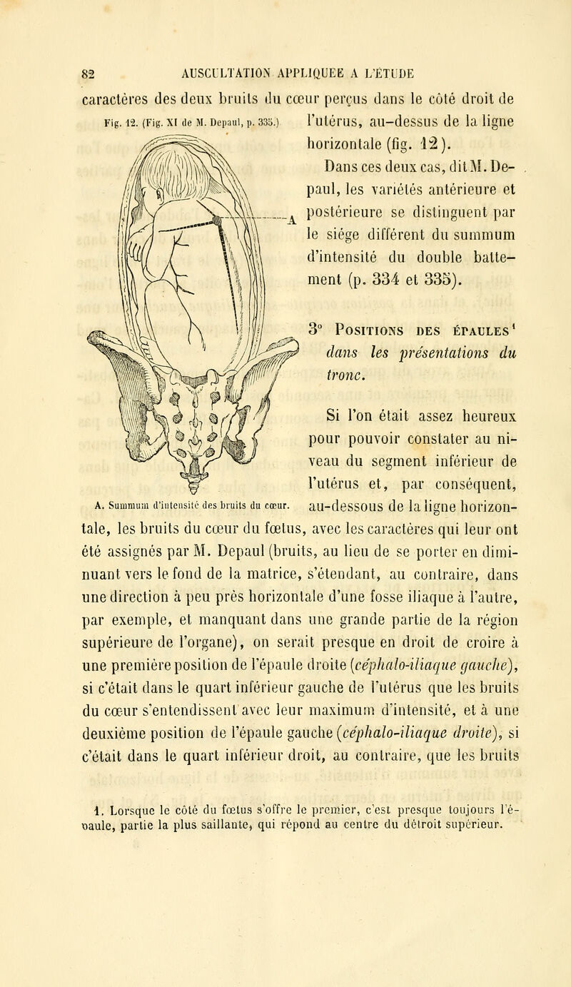 caractères des deux bruits du cœur perçus dans le côté droit de Fig. 12. (Fig. XI de M. Depaui, p. 335.) l'utérus, au-dessus de la ligne horizontale (fig. 1:2). Dans ces deux cas, dit M. De- paul, les variétés antérieure et postérieure se distinguent par le siège diffèrent du summum d'intensité du double batte- ment (p. 334 et 335). 3° Positions des épaules' dans les présentations du tronc. Si l'on était assez heureux pour pouvoir constater au ni- veau du segment inférieur de l'utérus et, par conséquent, A. Summum criuteasiié des bruits du cœur, au-dessous dc la ligne horizon- tale, les bruits du cœur du fœtus, avec les caractères qui leur ont été assignés par M. Depaul (bruits, au lieu de se porter en dimi- nuant vers le fond de la matrice, s'étendant, au contraire, dans une direction à peu près horizontale d'une fosse iliaque à l'autre, par exemple, et manquant dans une grande partie de la région supérieure de l'organe), on serait presque en droit de croire k une première position de l'épaule droite (céphalo-iliaque gauche), si c'était dans le quart inférieur gauche de l'utérus que les bruits du cœur s'entendissent avec leur maximum d'intensité, et à une deuxième position de l'épaule gauche [céphalo-iliaque droite), si c'était dans le quart inférieur droit, au contraire, que les bruits 4. Lorsque le côté du fœtus s'offre le premier, c'est presque toujours l'é- X)aule, partie la plus saillante, qui répond au centre du détroit supérieur.