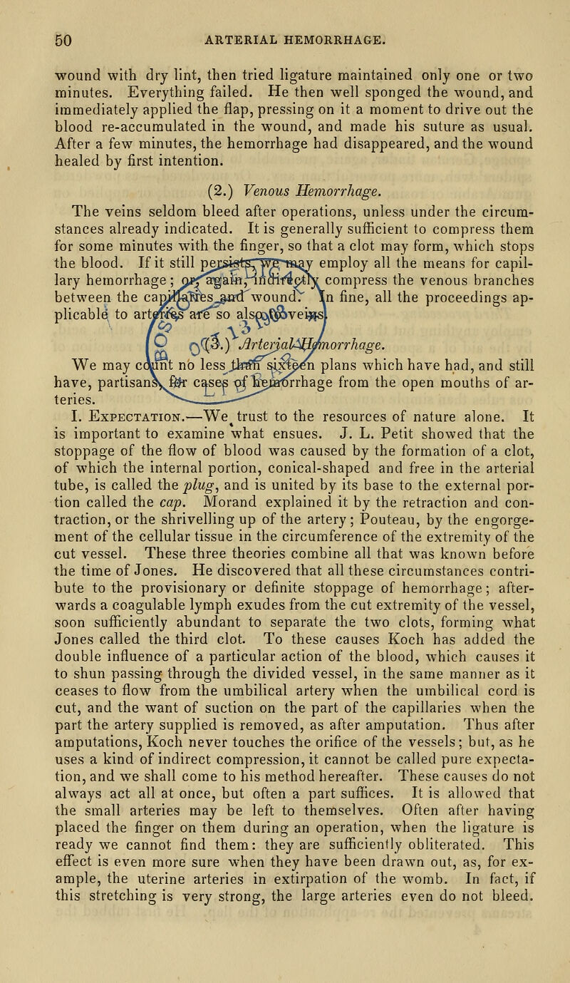 wound with dry lint, then tried ligature maintained only one or two minutes. Everything failed. He then well sponged the wound, and immediately applied the flap, pressing on it a moment to drive out the blood re-accumulated in the wound, and made his suture as usual. After a few minutes, the hemorrhage had disappeared, and the wound healed by first intention. (2.) Venous Hemorrhage. The veins seldom bleed after operations, unless under the circum- stances already indicated. It is generally sufficient to compress them for some minutes with the finger, so that a clot may form, which stops the blood. If it still pej:si«te Wfi^K^y employ all the means for capil- lary hemorrhage ;nf<^gafe,Hnait4c^IV compress the venous branches between the cag^!^^sjpid^wou^d. l^n fine, all the proceedings ap- plicable, to arts lorrhage. We may ccMnt no less^J;h^sii^l^n plans which have had, and still have, partisan\jli$r c^e^ ^^i^jarorrhage from the open mouths of ar- teries. I. Expectation.—We^ trust to the resources of nature alone. It is important to examine what ensues. J. L. Petit showed that the stoppage of the flow of blood was caused by the formation of a clot, of which the internal portion, conical-shaped and free in the arterial tube, is called the plug, and is united by its base to the external por- tion called the cap. Morand explained it by the retraction and con- traction, or the shrivelling up of the artery; Pouteau, by the engorge- ment of the cellular tissue in the circumference of the extremity of the cut vessel. These three theories combine all that was known before the time of Jones. He discovered that all these circumstances contri- bute to the provisionary or definite stoppage of hemorrhage; after- wards a coagulable lymph exudes from the cut extremity of the vessel, soon sufficiently abundant to separate the two clots, forming what Jones called the third clot. To these causes Koch has added the double influence of a particular action of the blood, which causes it to shun passing through the divided vessel, in the same manner as it ceases to flow from the umbilical artery when the umbilical cord is cut, and the want of suction on the part of the capillaries when the part the artery supplied is removed, as after amputation. Thus after amputations, Koch never touches the orifice of the vessels; but, as he uses a kind of indirect compression, it cannot be called pure expecta- tion, and we shall come to his method hereafter. These causes do not always act all at once, but often a part suffices. It is allowed that the small arteries may be left to themselves. Often after having placed the finger on them during an operation, when the ligature is ready we cannot find them: they are sufficiently obliterated. This effect is even more sure when they have been drawn out, as, for ex- ample, the uterine arteries in extirpation of the womb. In fact, if this stretching is very strong, the large arteries even do not bleed.
