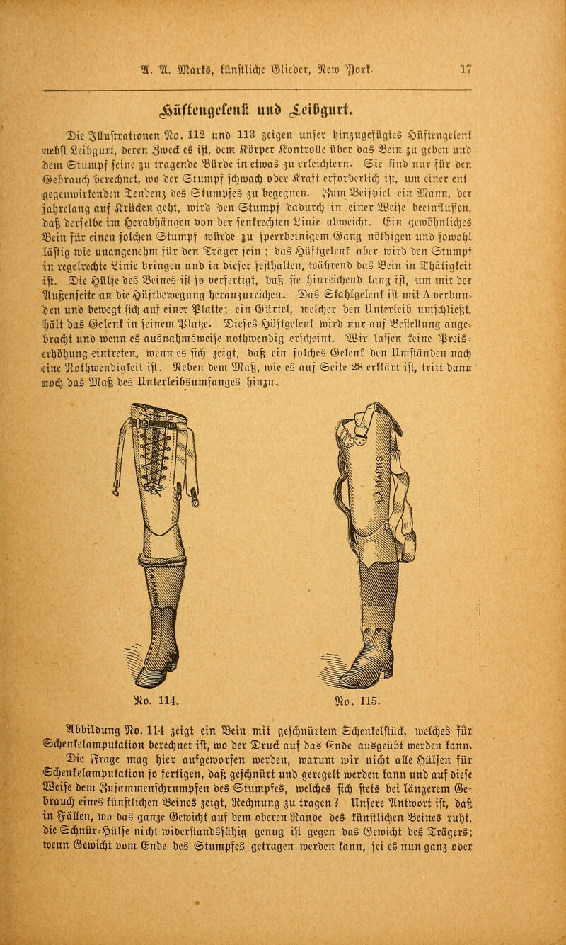 !Dte SÖuftrationen 9lo. 112 unb 113 geigen unfcr IjinsugefügteS $)üftengelenf atebft üeibgurt, beren 'Stv^ä c§ ift, bcm Körper .Kontrolle über tiaä SSein gu geben unb •bem «Stumpf feine ju tragenbe ©ürbe in ctwaS ju ericicfitern. Sie finb nur für bcn '©ebraud) bcred)nct, mo bcr ©lumpf fd^mai^ ober i^raft crforberlic^ ift, mti einer ent^ ■gegcnlDirfenben Sienbenj bc§ ©tumpfe§ ju begegnen. Sunt SSeifpiel ein 9}cann, ber jal^relang auf if rürfcn gef)t, niirb ten Stumpf baburc^ in einer 2Beife beetnfluffen, bafe berfelbe itn ^erabpng'cn t)on ber fenfre^^ten öinie abtncicfjt. (Sin gen)5l)nlic()e§ 18ein für einen fol(i)en Stumpf toürbe ju fperrbeinigem ©ang nötf)igen unb fotoo^I luftig mie unangenetint für ben Xräget fein ; iaä -^üftgclenf «ber mirb ben Stumpf in regelrechte Sinie bringen unb in bief er feftf)alten, toä'^renb bo§ Sein in SEIjätigfcit ift. ®ie §ülfe be§ 93eine§ ift fo üerfertigt, ba^ fie ^iureidienb lang ift, um mit ber Ulufeenfcite an bie ^üftbet^egung l^craujureidieu, ®q§ Staf)tg.elen! ift mit A tjerbun» .ben unb bettegt fid} auf einer platte; ein ©ürlel, toiläjex ben Unterteib umfd)IieBt, ■|)ält ba§ ©eleu! in feinem ^la^e. S)iefe§ ^üftgelcn! tnirb nur auf ScfleHung ange^ bra(^t UTtb toenn-e§uu§nat)m5iüeife nDtf)iücnbig erfc^eint. 'ffißir laffen feine SßreiS^ n't)ö^ung eintreten, inenn e§ fi(| geigt, ba^ ein fo(d)e§ ©elenf ben Umftänbcn naä^ «ine 5tDtt)toenbigfeit ift. hieben bem DJiafe, mie e§ auf Seit£ 28 erüärt ift, tritt bann tnoc^ baa SOial be^ Unt^erleibäumfangeS !|)in3u. IRo. 115. Ibbilbung ^o. 114 geigt ein ?8ettt mit gef(|nürtem Si^en!elftüc!, weld)el füt ©c^enfelamputatiott beret^net ift, too ber ®ruc£ auf ba§ @nbe ou§geübt »erben fanm S)ie grage mag l^ier aufgeinorfen merben, toarum mir nid^t äße .f^ülfen für Sd^enfelamputation fo fertigen, ba^ gefc^nürt unb geregelt twerben fonn unb auf biefe SBeife bem Sufammenfd^rumpfen be§ Stumpfe?, itielc^eS fid) fteti bei längerem ©e= braud^ eines fünftlid)en 93eine§ geigt, Died^nung gu tragen ? Unfere ^Intttjort ift, bafe in Ställen, too ba§ gange ©etoii^t auf bem oberen 9tanbe be§ fünftlic^ert S3eine§ rul^t, bieSd^nür^^üIfe tti(^t n3iberftanb§fäl)ig genug ift gegen ba§ ©eteid^t be§ S:räger§; ttjenn ©etoid^t Pom (Snbe be§ Stum^feS getragen merben !ann, fei eg nun gang ober