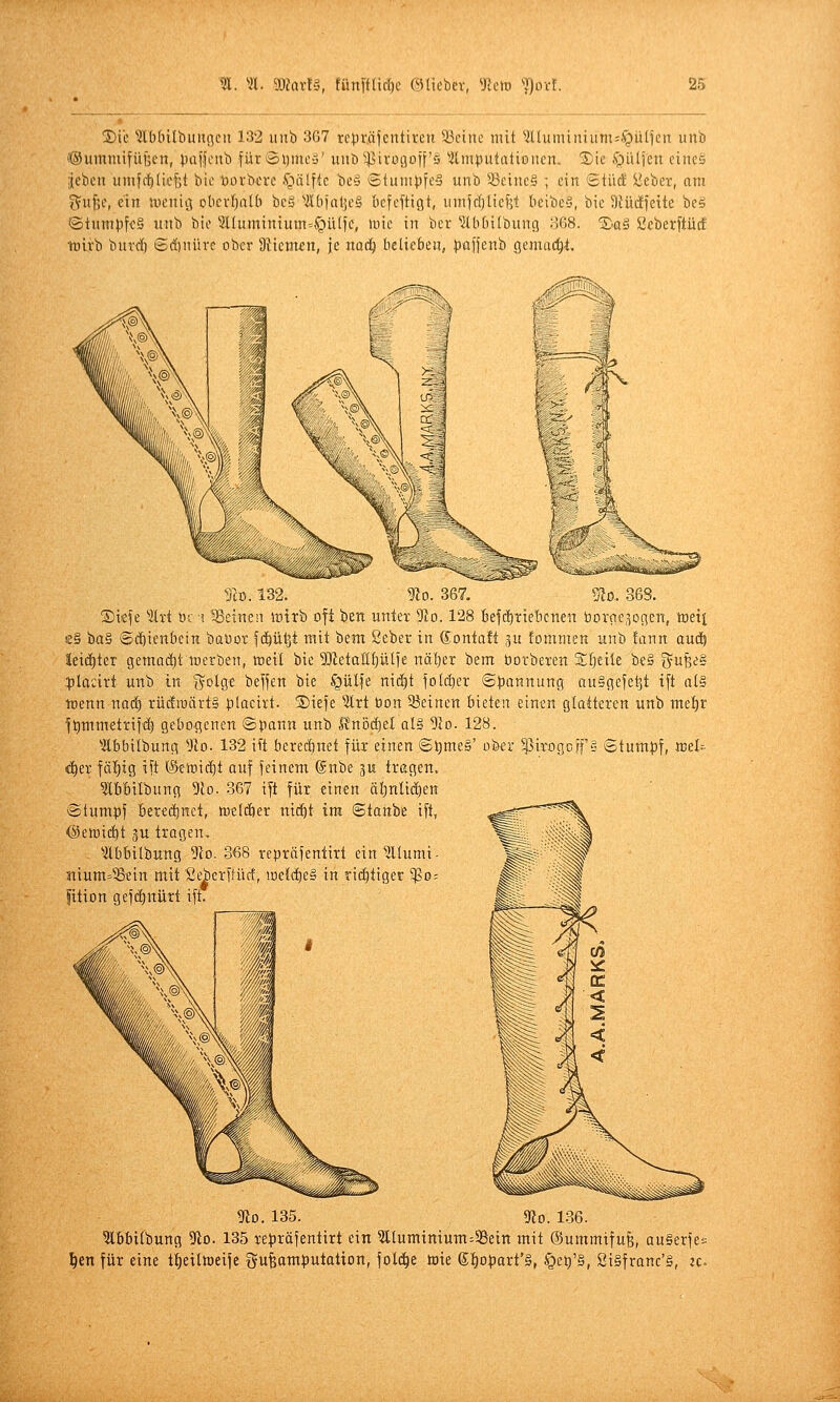 2Die TOMlbuitflcit 132 unb 367 rc)3r.äjentiren teilte mit ?llumiiüum=.^^ülfcn unb ©ummifüfeen, ^laffciib fürSymeä' uiib^45ivü9oi['G Imputationen, ^ic f^iitjen eines ;{ebcn umfit)[ief]t bie toovberc ■'gälfic be» ©tumpfeS unb ^-8cinc§ ; ein 'BiM ^cber, am fVuf^e, ein uienitj obcvIjaU) bcä '•Hbfaljcä bcfeftigt, umjrfjliefst beibeä, bie 9iüc!)eite be§ ©tumpfcS unb bie SUuminium-^üIfc, luic in ber ^Ibbitbung 368. ®a§ üeberftücf irlrb burtf) Sd)nitrc ober Ütiemfn, je ixac^ tieliefien, pafjenb gemacht. Tco. 132. «io. 367. mo.. 368. ®ieje ''Kxi üc i ^Beinen lt)trb oft ben untev 9lo. 128 Befc^tiebcnen üorac^ogen, toeii £§ ba§ ©(ä)ienbein baüov fi^üljt mit bem ßeber in Sontaft gu fommen unb !ann aui) leichter gemaäjtmerben, teeil bie SKetaÜfjüife näl}er bem borberen Sljeiie be§ gu^e§ :|)Ia£irt unb in lyolge beffen bie ^^ül^e niiä)t |o(d)er ©|)annung au§gefet]t ift al§ tüenn naä) rüc!roärt§ )3lacivt. ®iefe ?lrt öon 53einen bieten einen glatteren unb mefir ftimmetrifc^ gebogenen ©pann unb l?nö(^el al§ %o. 128. ''ilbbilbung ^Jlo. 132 ift berechnet für einen ©t)me§' ob-er ^3irogcrf § ©tum|)f, tüth <f)er fällig ift (§eti)icf)t auf feinem @nbe ju tragen. ^(bbilbung 5tD. 367 ift für einen ät)ntict)en ©tumpf hexiäjmi, tneldier nid^t im ©tanbe ift, <Seir)iiä)t gu tragen. ^Äbbilbung 5^o. 368 repräfentirt ein^Iumi- 3tium=^ein mit Seberftüct, iuetc{)e§ in rici)tiger 5)So= fition geföinürt ift. 5^0. 135. gio. 136. 3lbbitbung ^lo. 135 repräfentirt ein 5lluminium:58ein mit ©ummifufe, auSerfe^ ^en für eine t:^eiltt)eife gufeamputation, fold^e toie ßl^oparfS, ^e^'§, öi§franc'§, jc