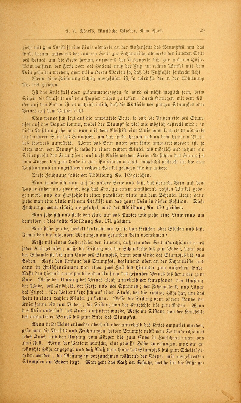 3iel)c mit icm iölciftift eine ßiiiie abiBävtS an ber ^lu^enfcite bc§ @lmn.^fe§, «m ta^ (Jnbc Ijcrum, aufluartä ber inneren 6eiie jur ©d)amleifte, ahwüxtä ber inneren 6eite be§ 5öeine§ um bie (vrefe Ijerum, aufmävtä ber lüiijienjeite &i§ ^ur anbereit .T;)Lifte. ^£cim pailiren ber ijerje ober be§ §acfcn§ muf] ber gu^ im redeten Söintet mit bem 35ein gef)aUen luerben, ober mit niiberen SBortcn jo, ha^ bie fyufeio{)(e fen!redjt ftefit. aOenn bieje Seif^nunö rid)lig auägefüljrt ift, fo iuirb fie ber in ber ?ll)f)ilbung Diu. 1C8 gteidjen. Sft ba5 ilnie fteif ober 3u|ammenge3ogen, fo toirb e§ ni(^t mögUd) fein, beim *Sil]en bie Sfüdfeite auf bem ^Papier rut)en ju laf)en ; buvd) ipintegen mit bem. 3iü dm auf beit 23obcn ift c§ inal;rfd)einlid), ba^ bie 3tü(ffeite bc§ gangen ©tumpfeS ober SSeine^ auf bem 5pa)3ier tul)t. Wan toenbe fid) jeljt ouf bie amputirte ©eite, |o baj? bie ?lujienieite be§ ©tum-- pfe§ auf haä Rapier fommt, Wobei ber ©tumpf fo öiel ioie möglid) aeftrecft wirb ; in bicfer 5)^ofitiün 3ietje man nun mit bem ^-Bleiftift eine Sinte tiom Unterleibe abwärts ber borberen ©eite be§ ©tumpfeS, um bo§ ©nbe I)erum unb an bem ^^intcren Stljeilc be§ lt'öi|3cr§ aufwärt». 28enn ba§ 58ein unter bem ft'nie amputirt werben ift, fo biege man ben ©tumpf fo naf)e in einen red)ten Söinfel a(§ möglid; unb nel)me ein ©citenprofit be§ ©tumpfea ; auf biefe 233ei)e werben ©eiten;''2lnfid)ten beö ©tumpfeS üom iiörper bi§ jum (Snbe in jwei ^ofitionen ge3cigt, mDgUd)ft geftredt für bie eine Sßofition unb in ungefätjrem rei^tem äöin!et gebogen für bie anbere. Siefe Seic^nuttg foKte ber ^Ibbilbung ?co. 1G9 gicidjen. 5Dian wenbe [lä) nun auf bie anbere ©eite unb laffe ba§ gefunbe SSein ouf bem Rapier Xül)cn unD jwar |o, ba| haä ft'nie ju einem annä()ernb rett)ten 2öinfel gebo; gen Wirb unb bie gu|^fol)Ie in einer paroltelen ßtnie mit htm ©d)enfel liegt; baiia jie^e man eine iiinie mit bem SBleiftift um 'M§ gange SSein in biefer ^ofttion. ©iefe vSei(3^nung, wenn rid^tig ausgefütirt, wirb ber ''Äbbilbung 5io. 170 gleichen. ajfan je^e fid) unb ftetle ben gujj auf ba§ ^ßapier unb §iet)e eine Sinie runb um benfelben ; bie§ foEte %bbilbung 5to. 171 gleichen. Wlan ftelje gerabe, perfett fenfred}t mit i^ülfe Don Brüden ober ©tö&n unb lajfe Semanben bie fotgenben SOteffungen am gefunben 33ein tiornel)mcn : SOZeffe mit einem Saftergirfel ben inneren, äußeren ober ©eitenburd)fd)nitt eines jeben Ä'niegelenfeS ; meffe bie Siftanjüon ber ©d)amleifte bi» gum ^-Boben, bann oon ber ©diamlcifte bis gum @nbe be§©tumpfe§, bann öom @nbe be§ ©tumpfeS bis jum 58oben. ^IJleffe ben Umfang beS ©tumpfeS, beginnenb oben an ber ©cf)amleifte unb bann in 3töifÄ)enräumen bon etwa gwei Soll bis l)inunter gum äu^erften ©nbc SKeffe ben l)iermit correfponbirenben Umfang beS gefunben Seines bis herunter jum ^nie. 53teffe \)m Umfang beS SSeineS gleich unterijalb ber Äniepfanne, ben Umfang ber SBabe, beS ft'nödjetS, ber gerfe unb beS ©panneS ; ber Sef)engc(ertfe unb Sänge beS lyuBeS ; Ser 5ßatient felje fid) auf einen ©tul)l, ber bie rid^tige .'pij^e l)at, um baS 58ein in einen red)ten Söinfcl ju ftetten. 2Keffe bie Siftang bom oberen Dknbe ber ^niepfanne bis gum ^Bobeu ; bie Stiftung üon ber .^niefe^le biS gum §8oben. 2!Benn ba§ 58ein unterfialb beS ft'nieS amputirt würbe, SOJeffe bie ©iftanj üon ber l£me!el)le beS amputirten Seines bis jum ®nbe beS ©tumpfeS. äßenn beibeSSeine entWeber oberl)alb ober unterhalb beS ,SnieS amputirt Würben, gebe man bie ^Profils unb Zeichnungen beiber ©iumpfe nebfi bem ©eitenburd)irf)n;tt jebeS J?nieS unb ben Umfang öom l^örper bis gum ®nbe in <]wifd)enräumeu oon 3Wet Sott. Sßenn ber ^Patient Wünfdjt, eine gewiffe §öl)e ju erlangen, mufe bie gc- Wünfd)te §öl)e angegeigt unb ba§ 5Kafe öom gnbe beS ©tumpfeS bis gum ©c^eitel ge^ geben Werben ; bie 9)leffung ift borgunel^men wäl)renb ber JSörper mit auSgeftrecfteu Stumpfen am Soben liegt. 9Kan gebe boS aJiafe ber ©d^ulie, welche für bie güfee ge=