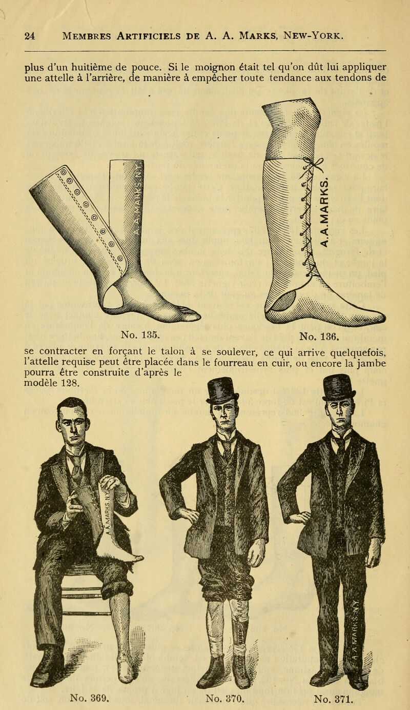 plus d'un huitième de pouce. Si le moignon était tel qu'on dût lui appliquer une attelle à l'arrière, de manière à empêcher toute tendance aux tendons de No. 135. No. 136. se contracter en forçant le talon à se soulever, ce qui arrive quelquefois, l'attelle requise peut être placée dans le fourreau en cuir, ou encore la jambe pourra être construite d'après le modèle 138.