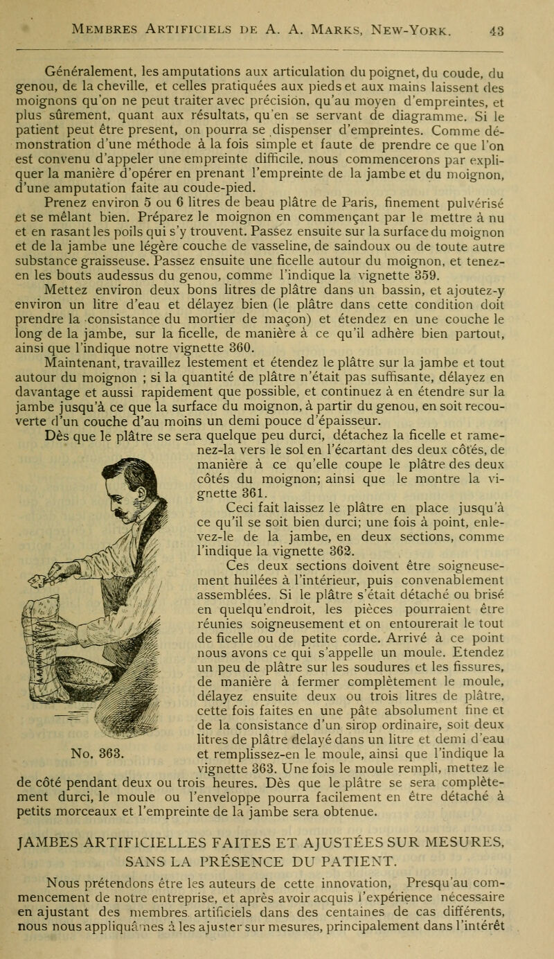 Généralement, les amputations aux articulation du poignet, du coude, du genou, de la cheville, et celles pratiquées aux pieds et aux mains laissent des moignons qu'on ne peut traiter avec précision, qu'au moyen d'empreintes, et plus sûrement, quant aux résultats, qu'en se servant de diagramme. Si le patient peut être présent, on pourra se dispenser d'empreintes. Comme dé- monstration d'une méthode à la fois simple et faute de prendre ce que l'on est convenu d'appeler une empreinte difficile, nous commencerons par expli- quer la manière d'opérer en prenant l'empreinte de la jambe et du moignon, d'une amputation faite au coude-pied. Prenez environ 5 ou 6 litres de beau plâtre de Paris, finement pulvérisé et se mêlant bien. Préparez le moignon en commençant par le mettre à nu et en rasant les poils qui s'y trouvent. Passez ensuite sur la surface du moignon et de la jambe une légère couche de vasseline, de saindoux ou de toute autre substance graisseuse. Passez ensuite une ficelle autour du moignon, et tenez- en les bouts audessus du genou, comme l'indique la vignette 359. Mettez environ deux bons htres de plâtre dans un bassin, et ajoutez-y environ un litre d'eau et délayez bien (le plâtre dans cette condition doit prendre la consistance du mortier de maçon) et étendez en une couche le long de la jambe, sur la ficelle, de manière à ce qu'il adhère bien partout, ainsi que l'indique notre vignette 360. Maintenant, travaillez lestement et étendez le plâtre sur la jambe et tout autour du moignon ; si la quantité de plâtre n'était pas suffisante, délayez en davantage et aussi rapidement que possible, et continuez à en étendre sur la jambe jusqu'à ce que la surface du moignon, à partir du genou, en soit recou- verte d'un couche d'au moins un demi pouce d'épaisseur. Dès que le plâtre se sera quelque peu durci, détachez la ficelle et rame- nez-la vers le sol en l'écartant des deux côtés, de manière à ce qu'elle coupe le plâtre des deux côtés du moignon; ainsi que le montre la vi- gnette 361. Ceci fait laissez lé plâtre en place jusqu'à ce qu'il se soit bien durci; une fois à point, enle- vez-le de la jambe, en deux sections, comme l'indique la vignette 362, Ces deux sections doivent être soigneuse- ment huilées à l'intérieur, puis convenablement assemblées. Si le plâtre s'était détaché ou brisé en quelqu'endroit, les pièces pourraient être réunies soigneusement et on entourerait le tout de ficelle ou de petite corde. Arrivé à ce point nous avons ce qui s'appelle un moule. Etendez un peu de plâtre sur les soudures et les fissures, de manière à fermer complètement le moule, délayez ensuite deux ou trois litres de plâtre, cette fois faites en une pâte absolument fine et de la consistance d'un sirop ordinaire, soit deux litres de plâtre délayé dans un litre et demi d'eau et remplissez-en le moule, ainsi que l'indique la vignette 363. Une fois le moule rempli, mettez le de côté pendant deux ou trois heures. Dès que le plâtre se sera complète- ment durci, le moule ou l'enveloppe pourra facilement en être détaché à petits morceaux et l'empreinte de la jambe sera obtenue. No. 363. JAMBES ARTIFICIELLES FAITES ET AJUSTÉES SUR MESURES, SANS LA PRÉSENCE DU PATIENT. Nous prétendons être les auteurs de cette innovation, Presqu'au com- mencement de notre entreprise, et après avoir acquis l'expérience nécessaire en ajustant des membres, artificiels dans des centaines de cas différents, nous nous appliquâ'^nes à les ajuster sur mesures, principalement dans l'intérêt