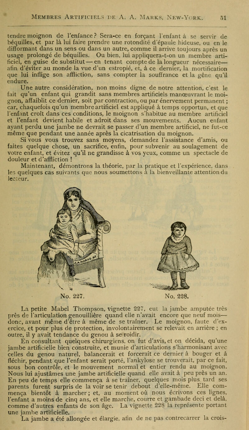 tendre moignon de l'enfance ? Sera-ce en forçant l'enfant à se servir de béquilles, et par là lui faire prendre une rotondité d'épaule hideuse, ou en le difformant dans un sens ou dans un autre, comme il arrive toujours a])rès un usage prolongé de béquilles. Ou bien, lui appliquera-t-on un membre arti- ficiel, en guise de substitut — en tenant compte de la longueur nécessaire— afin d'éviter au monde la vue d'un estropié, et, à ce dernier, la mortification que lui inflige son affliction, sans compter la souffrance et la gêne qu'il endure. Une autre considération, non moins digne de notre attention, c'est le fait qu'un enfant qui grandit sans membres artificiels manœuvrant le moi- gnon, affaiblit ce dernier, soit par contraction, ou par énervement permanent ; car, chaquefois qu'un membre artificiel est appliqué à temps opportun, et que l'enfant croît dans ces conditions, le moignon s'habitue au membre artificiel et l'enfant devient habile et adroit dans ses mouvements. Aucun enfant ayant perdu une jambe ne devrait se passer d'un membre artificiel, ne fut-ce même que pendant une année après la cicatrisation du moignon. Si vous vous trouvez sans moyens, demandez l'assistance d'amis, ou faites quelque chose, un sacrifice, enfin, pour subvenir au soulagement de votre enfant, et évitez qu'il ne grandisse à vos yeux, comme un spectacle de douleur et d'affliction ! Maintenant, démontrons la théorie, par la pratique et l'expérience, dans les quelques cas suivants que nous soumettons à la bienveillante attention du lecteur. No. 227. No. 228. La petite Mabel Thompson, vignette 227, eut la jambe amputée très près de l'articulation genouillière quand elle n'avait encore que neuf mois— donc, avant même d'être à même de se traîner. Le moignon, faute d'ex- ercice, et pour plus de protection, involontairement se relevait en arrière ; en outre, il y avait tendance du genou à se roidir. En consultant quelques chirurgiens, on fut d'avis, et on décida, qu'une jambe artificielle bien construite, et munie d'articulations s'harmonisant avec celles du genou naturel, balancerait et forcerait ce dernier à bouger et à fléchir, pendant que l'enfant serait porté, l'ankylose se trouverait, par ce fait, sous bon contrôle, et le mouvement normal et entier rendu au moignon. Nous lui ajustâmes une jambe artificielle quand elle avait à peu près un an. En peu de temps elle commença à se traîner, quelques mois plus tard ses parents furent surpris de la voir se tenir debout d'elle-même. Elle com- mença bientôt à marcher ; et, au moment où nous écrivons ces lignes, l'enfant a moins de cinq ans, et elle marche, courre et gambade deci et delà, comme d'autres enfants de son âge. La vignette 228 la représente portant une jambe artificielle. La jambe a été allongée et élargie, afin de ne pas contrecarrer la crois-