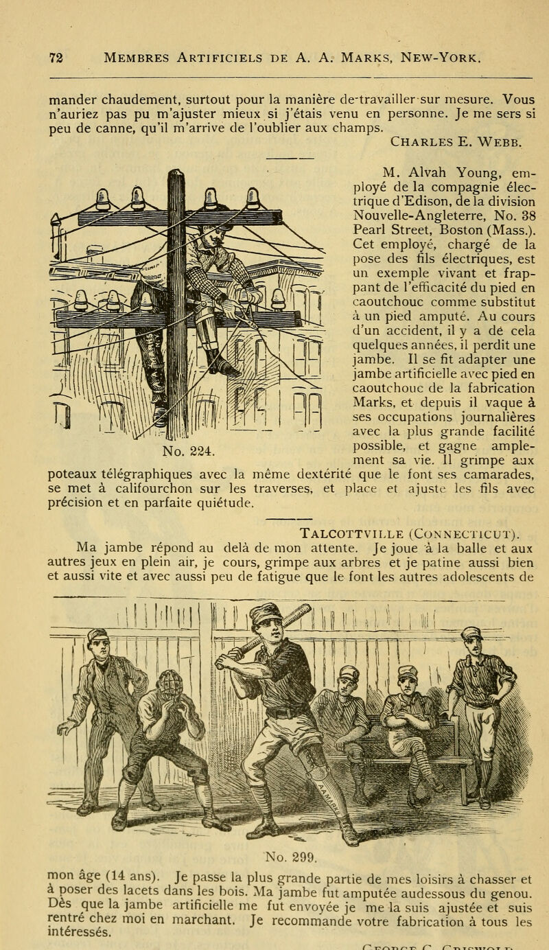 mander chaudement, surtout pour la manière de-travaillersur mesure. Vous n'auriez pas pu m'ajuster mieux si j'étais venu en personne. Je me sers si peu de canne, qu'il m'arrive de l'oublier aux champs. Charles E. Webb. M. Alvah Young, em- ployé de la compagnie élec- trique d'Edison, de la division Nouvelle-Angleterre, No. 38 Pearl Street, Boston (Mass.). Cet employé, chargé de la pose des fils électriques, est un exemple vivant et frap- pant de l'efficacité du pied en caoutchouc comme substitut à un pied amputé. Au cours d'un accident, il y a dé cela quelques années, il perdit une jambe. Il se fit adapter une jambe artificielle avec pied en caoutchouc de la fabrication Marks, et depuis il vaque à ses occupations journalières avec la plus grande facilité possible, et gagne ample- ment sa vie. Il grimpe aux poteaux télégraphiques avec la même dextérité que le font ses camarades, se met à califourchon sur les traverses^ et place et ajuste les fils avec précision et en parfaite quiétude. Talcottville (Connecticut). Ma jambe répond au delà de mon attente. Je joue à la balle et aux autres jeux en plein air, je cours, grimpe aux arbres et je patine aussi bien et aussi vite et avec aussi peu de fatigue que le font les autres adolescents de No. 299. mon âge (14 ans). Je passe la plus grande partie de mes loisirs à chasser et à poser des lacets dans les bois. Ma jambe fut amputée audessous du genou. Dès que la jambe artificielle me fut envoyée je me la suis ajustée et suis rentré chez moi en marchant. Je recommande votre fabrication à tous les mtéressés. ^ TT/-v n/^-r- f n-r^ T C^IIT/^ T -T.