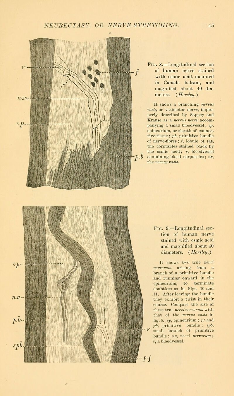 Fig. 8.—Longitudinal section of human nerve stained witli osmic acid, mounted in Canada balsam, and magnified about 40 dia- meters. {Horslet/.) It shows a branching nervus vasis, or vasimotor nerve, impro- perly describerl by Sappey and Krause as a nervtis nervi, accom- panying a small bloodvessel; ep, epineurium, or sheath of connec- tive tissue ; ^6, primitive bundle of nerve-flbres ; /, lobule of fat, the corpuscles stained b'.ack by the osmic acid; v, bloodvessel containing blood corpuscles ; nv, the nei-ous vcms. Fig. 9.—Longitudinal sec- tion of human nerve stained with osmic acid and magnified about 40 diameters. {Horsley.') It shows two true nervi nervorum arising from a branch of a primitive bundle and running onward in the epineurium, to terminate doubtless as in Figs. 10 and 11. After leaving the bundle they exhibit a twist in their course. Compare the size of these true nei-vi nervorum with that of the nervus va.ns in flg. 8. ep, epineurium ; pf and ph, primitive bundle ; spb, ^ small branch of primitive bundle ; nn, nervi nervorum ; V, a bloodvessel. Pi