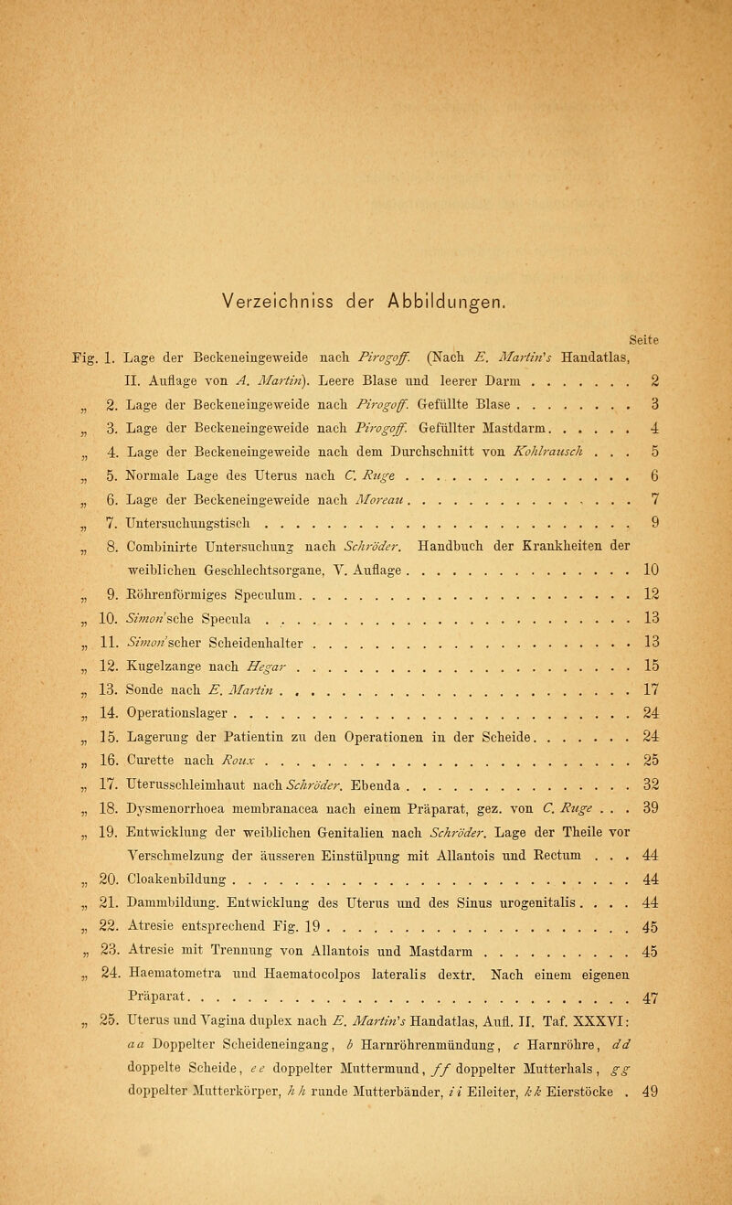 Verzeichniss der Abbildungen. Seite Fig. 1. Lage der Beckeneingeweide nach Pirogoff. (Nach E. Martinas Handatlas, II. Auflage von A. Martin). Leere Blase und leerer Darm 2 2. Lage der Beckeneingeweide nach Pirogoff. Gefüllte Blase 3 3. Lage der Beckeneingeweide nach Pirogoff. Gefüllter Mastdarm 4 4. Lage der Beckeneingeweide nach dem Durchschnitt von Kohlrausch ... 5 5. Normale Lage des Uterus nach C. Rüge 6 6. Lage der Beckeneingeweide nach Moreau , . . . 7 7. Untersuchungstisch 9 8. Combinirte Untersuchung nach Schröder. Handbuch der Krankheiten der weiblichen Geschlechtsorgane, V. Auflage 10 9. Röhrenförmiges Speculum 12 10. Simon'sche Specula 13 11. Simonschev Scheidenhalter 13 12. Kugelzange nach Hegar 15 13. Sonde nach E. Martin 17 14. Operationslager 24 15. Lagerung der Patientin zu den Operationen in der Scheide 24 16. Curette nach Roux 25 17. Uterusschleimhaut nach Schröder. Ebenda 32 18. Dysmenorrhoea membranacea nach einem Präparat, gez. von C. Rüge ... 39 19. Entwicklung der weiblichen Genitalien nach Schi-öder. Lage der Theile vor Verschmelzung der äusseren Einstülpung mit Allantois und Rectum ... 44 20. Cloakenbildung 44 21. Dammbildung. Entwicklung des Uterus und des Sinus urogenitalis .... 44 22. Atresie entsprechend Fig. 19 45 23. Atresie mit Trennung von Allantois und Mastdarm 45 24. Haematometra und Haematocolpos lateralis dextr. Nach einem eigenen Präparat 47 25. Uterus und Vagina duplex nach E. Martins Handatlas, Aufl. II. Taf. XXXVI: aa Doppelter Scheideneingang, b Harnröhrenmündung, c Harnröhre, dd doppelte Scheide, e e doppelter Muttermund, // doppelter Mutterhals , gg doppelter Mutterkörper, h h runde Mutterbänder, ii Eileiter, kk Eierstöcke . 49