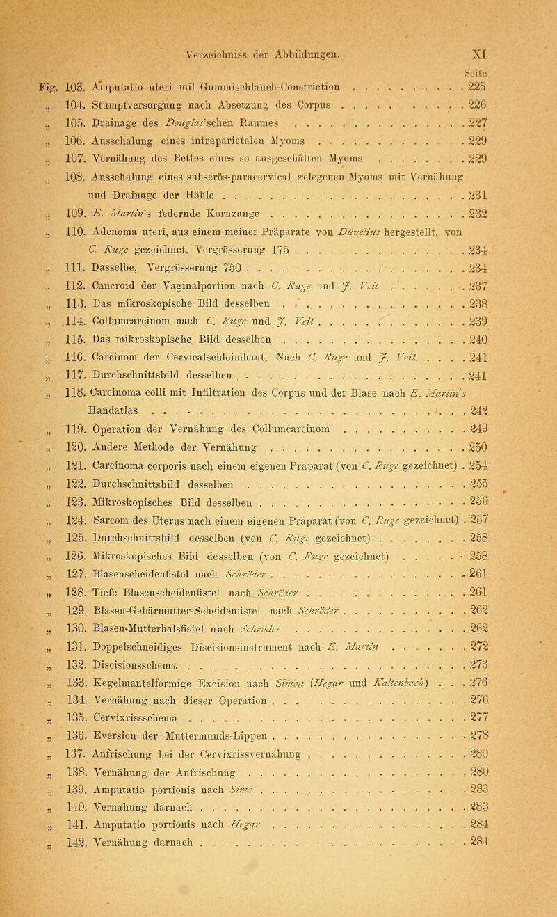 Seite ig. 103. Amputatio uteri mit Gummischlauch-Constriction , 225 104. Stumpf Versorgung nach Absetzung des Corpus 226 105. Drainage des Douglas'sehen Raumes 227 106. Ausschälung eines intraparietalen Hyoms 229 107. Vernähung des Bettes eines so ausgeschälten Myoms 229 108. Ausschälung eines subserös-paracervical gelegenen Myoms mit Vernähimg und Drainage der Höhle 231 109. E. Afartin's federnde Ivornzange 232 110. Adenoma uteri, aus einem meiner Präparate von Düvelius hergestellt, von C. Rüge gezeichnet. Vergrösserung 175 234 111. Dasselbe, Vergrösserung 750 234 112. Cancroid der Vaginalportion nach C. Rüge und y. Veit 237 113. Das mikroskopische Bild desselben . 238 114. Collumcarcinom nach C. Rüge und y. Veit 239 115. Das mikroskopische Bild desselben 240 116. Carcinom der Cervicalschleimhaut. Nach C. Rüge und y. Veit . . . .241 117. Durchschnittsbild desselben ( 241 118. Carcinoma colli mit Infiltration des Corpus und der Blase nach E. Martins Handatlas 242 119. Operation der Vernähung des Collumcarcinom 249 120. Andere Methode der Vernähung 250 121. Carcinoma corporis nach einem eigenen Präparat (von C. Rüge gezeichnet) . 254 122. Durchschnittsbild desselben 255 123. Mikroskopisches Bild desselben 256 124. Sarcom des Uterus nach einem eigenen Präparat (von C. Riege gezeichnet) . 257 125. Durchschnittsbild desselben (von C. Rüge gezeichnet) . 258 126. Mikroskopisches Bild desselben (von C, Riege gezeichnet) • 258 127. Blasenscheidenfistel nach Schröder 261 128. Tiefe Blasenscheidenfistel nach Schröder 261 129. Blasen-Gebärmutter-Scheidenfistel nach Schröder 262 130. Blasen-Mutterhalsfistel nach Schröder , . . . 262 131. Doppelschneidiges Discisionsinstrument nach E. Martin 272 132. Discisionsschema 273 133. Kegelmantelförmige Excision nach Simon (Hegar und Kaltenbacli) . . . 276 134. Vernähung nach dieser Operation 276 135. Cervixrissschema 277 136. Eversion der Muttermunds-Lippen 27S 137. Anfrischung bei der Cervixrissvernälrang 280 138. Vernähung der Anfrischung 280 139. Amputatio portionis nach Sims 283 140. Vernähung darnach 283 141. Amputatio portionis nach Hegar 284 142. Vernähung darnach 284